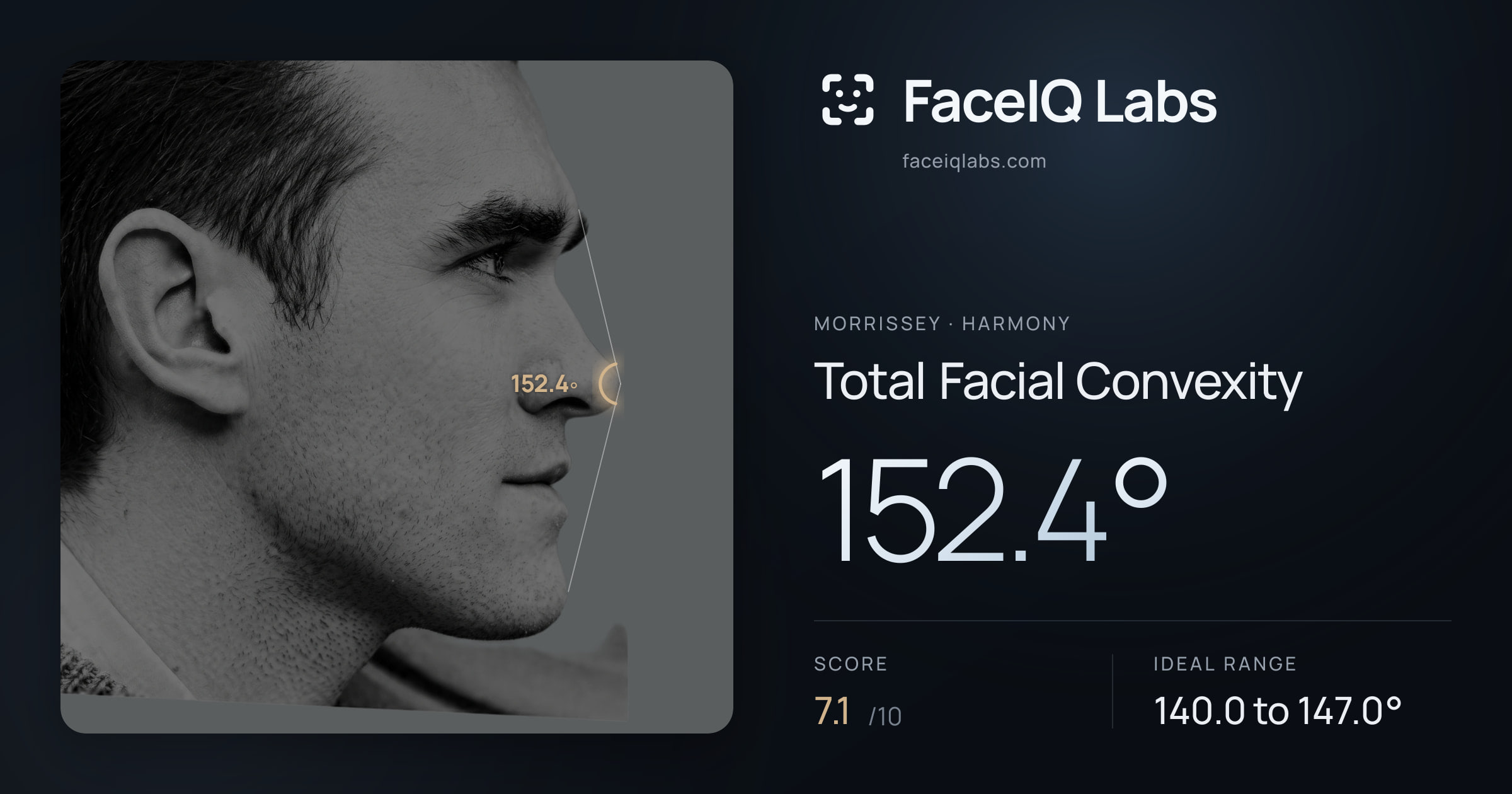 Morrissey Total Facial Convexity: 152.4°, drawn on the photo