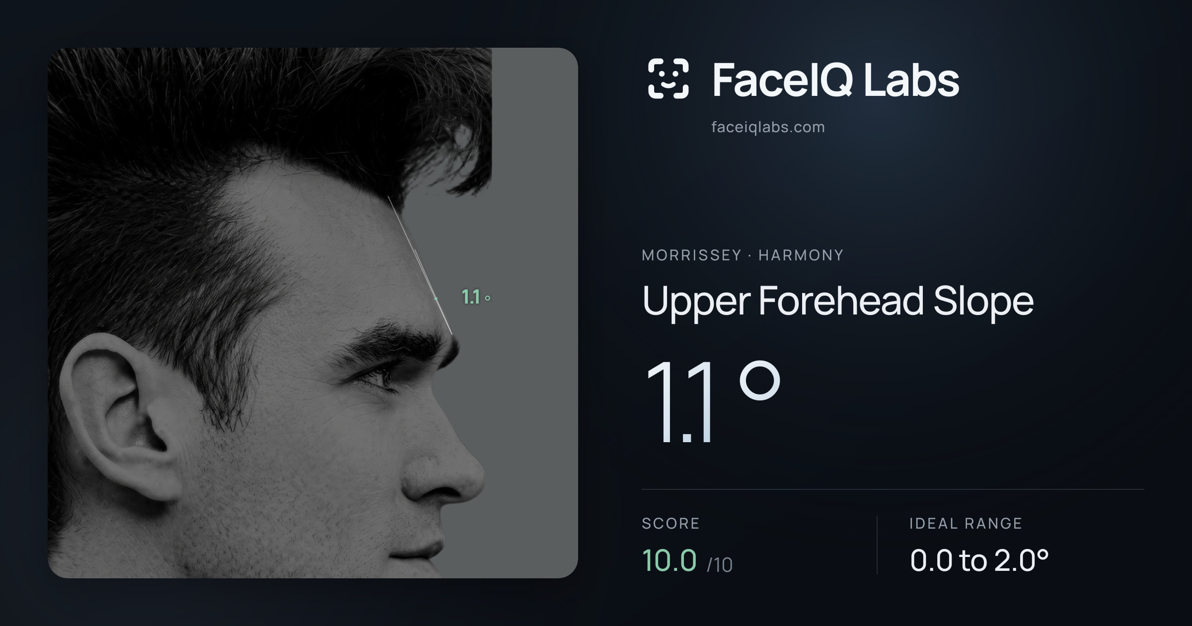 Morrissey Upper Forehead Slope: 1.1°, drawn on the photo