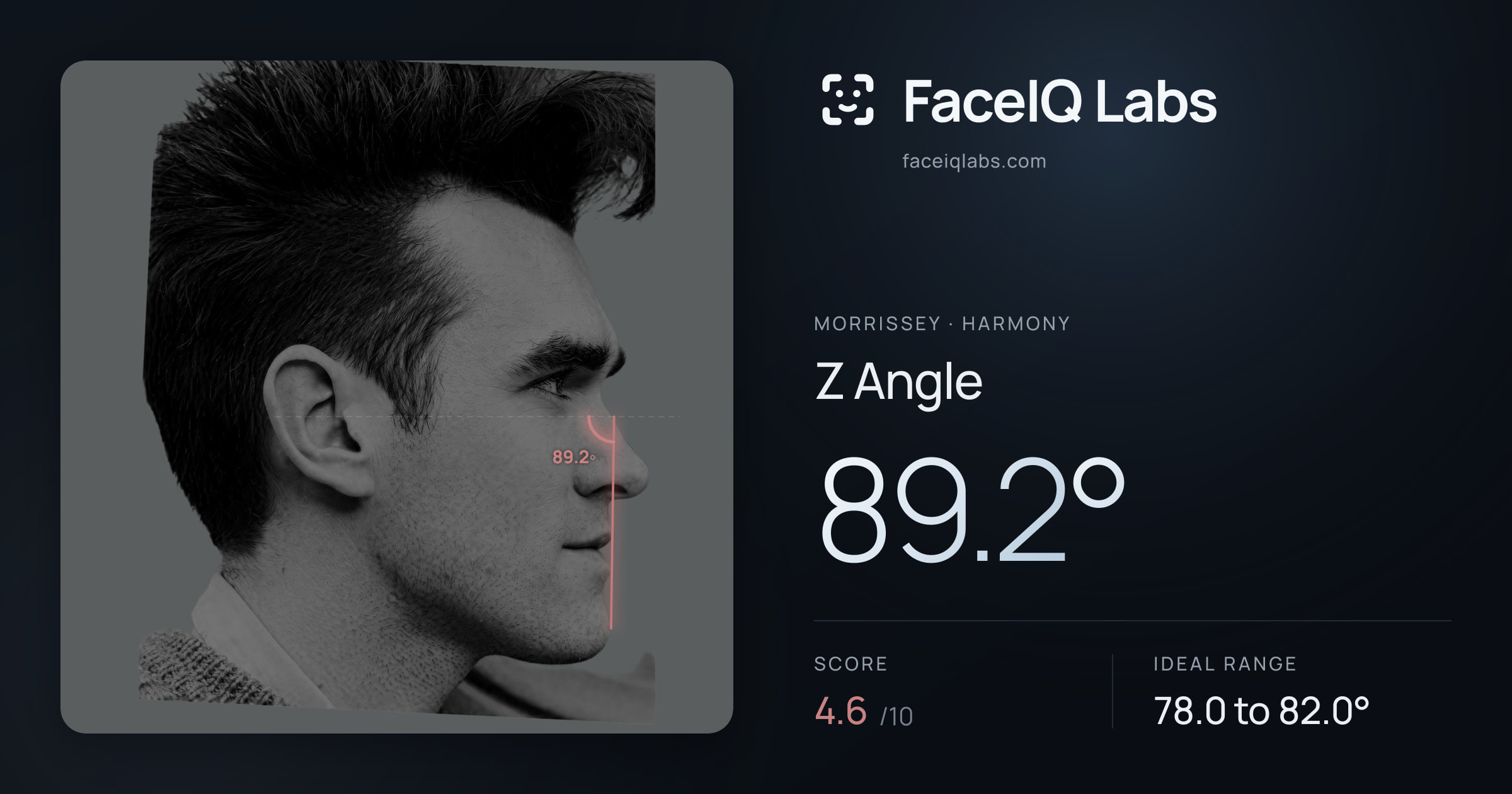 Morrissey Z Angle: 89.2°, drawn on the photo