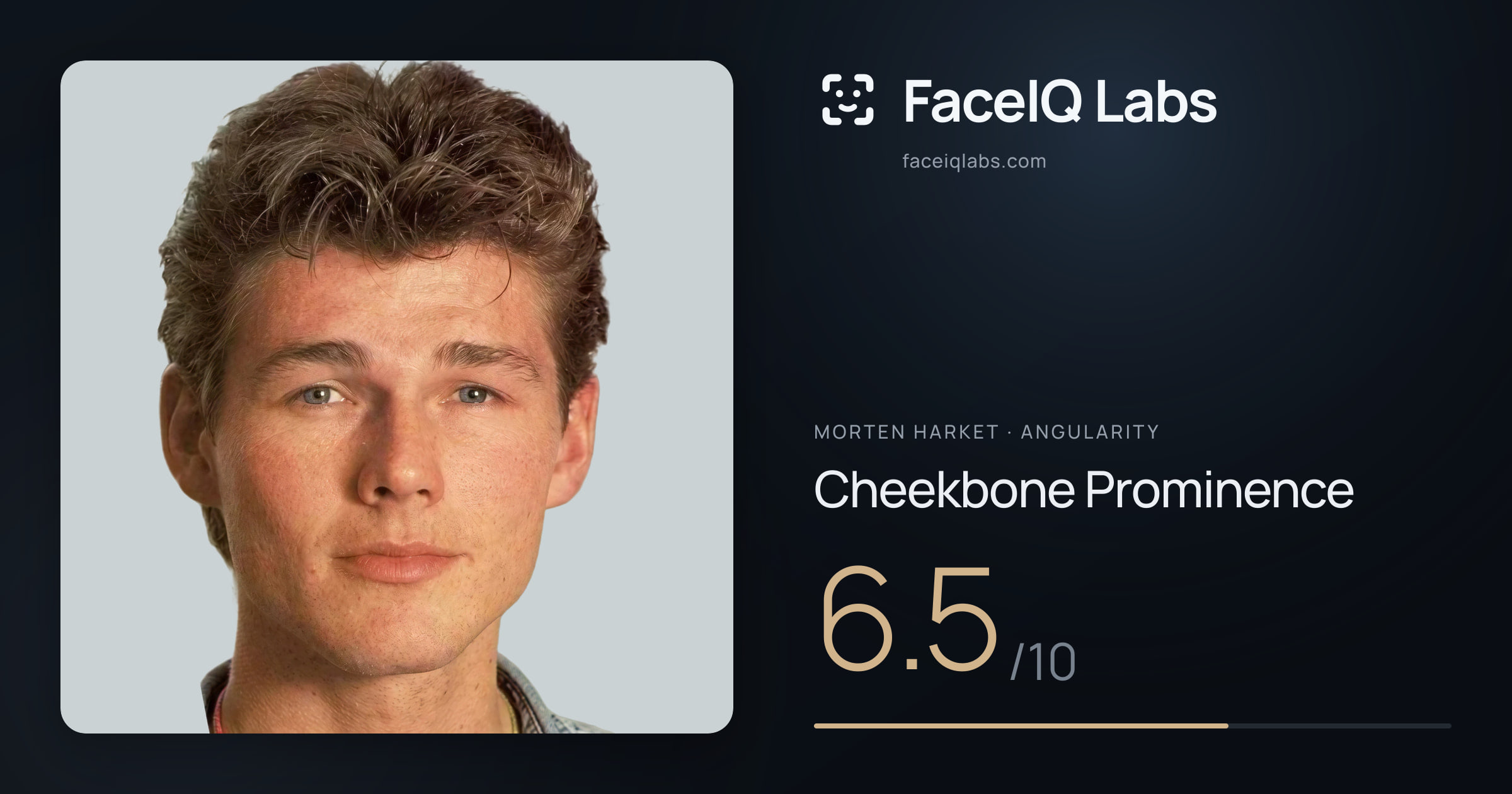 Morten Harket Cheekbone Prominence: 6.5/10, drawn on the photo