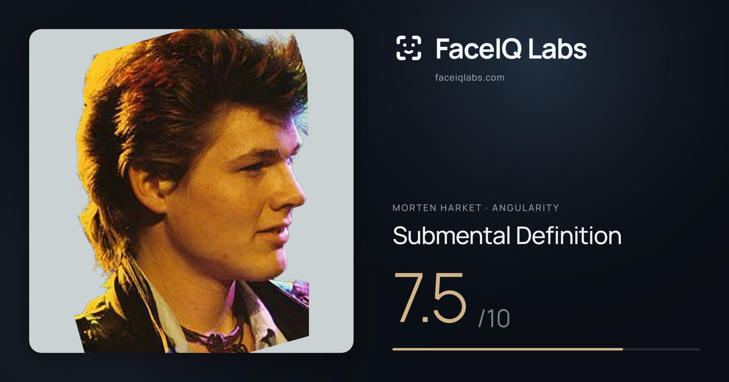 Morten Harket Submental Definition: 7.5/10, drawn on the photo