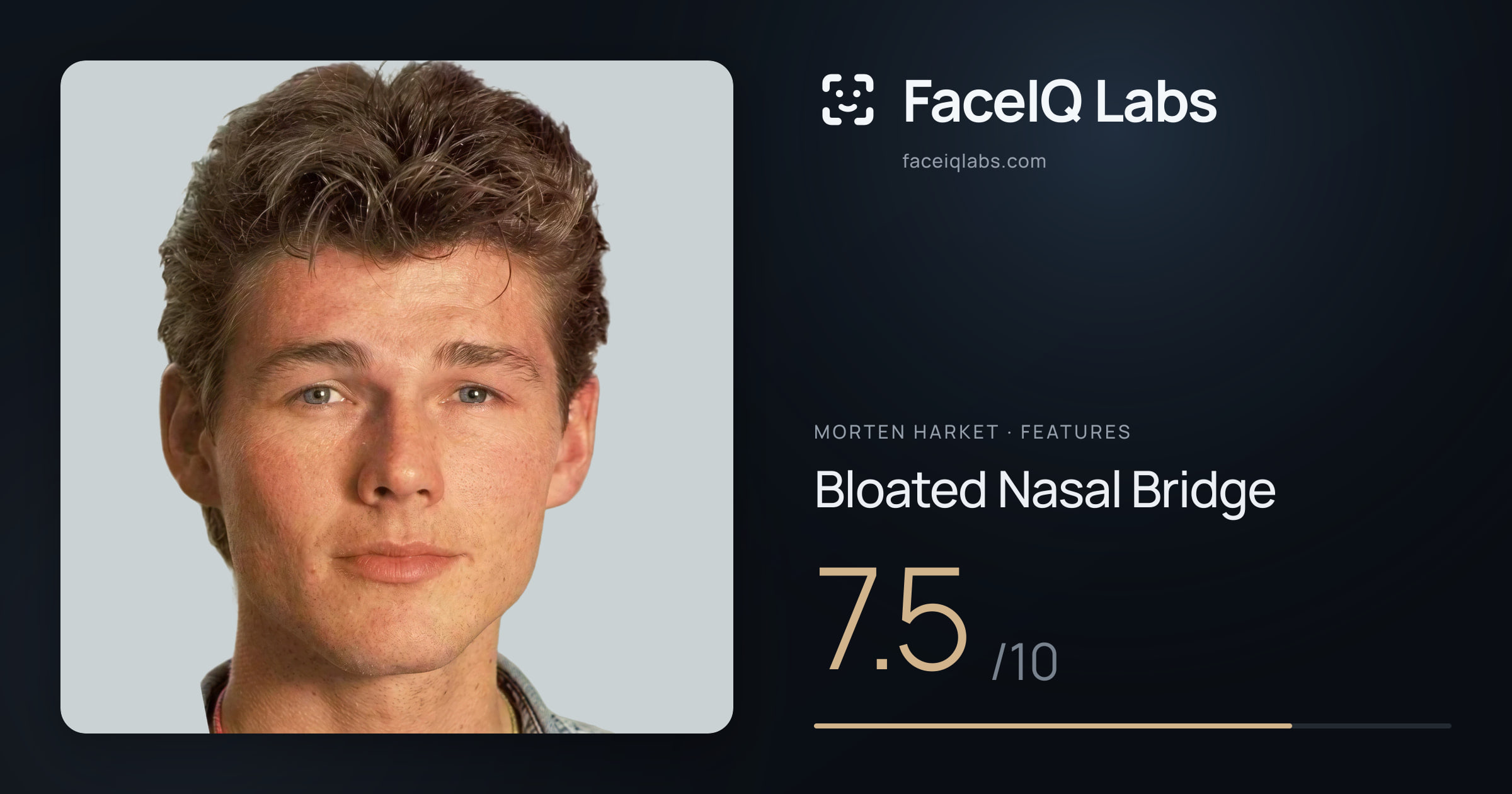 Morten Harket Bloated Nasal Bridge: 7.5/10, drawn on the photo