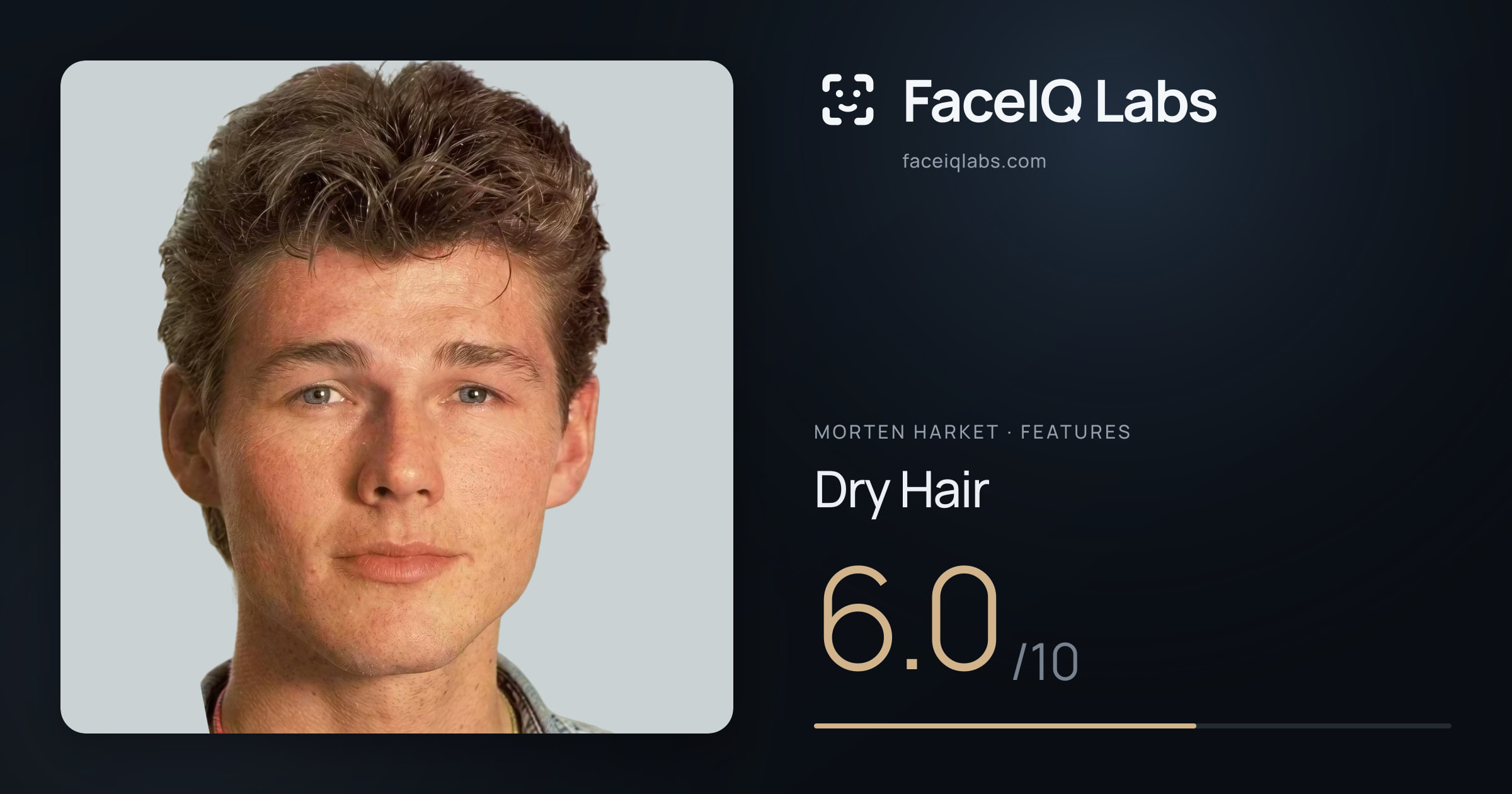 Morten Harket Dry Hair: 6.0/10, drawn on the photo