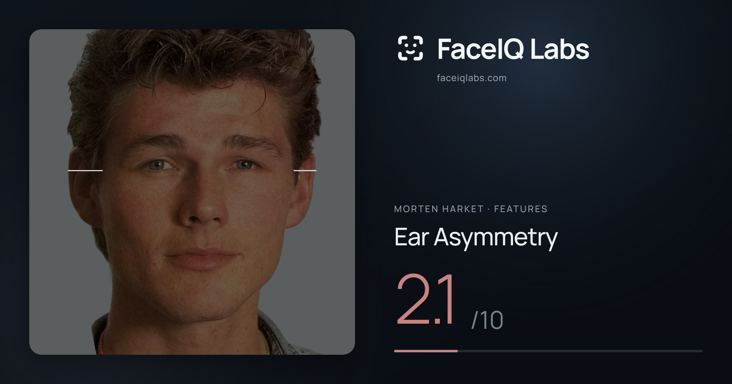 Morten Harket Ear Asymmetry: 2.1/10, drawn on the photo