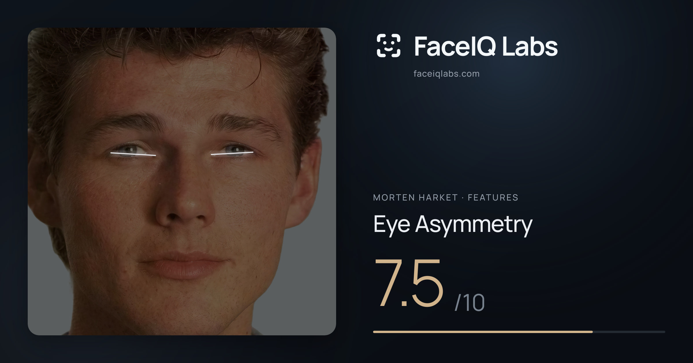 Morten Harket Eye Asymmetry: 7.5/10, drawn on the photo
