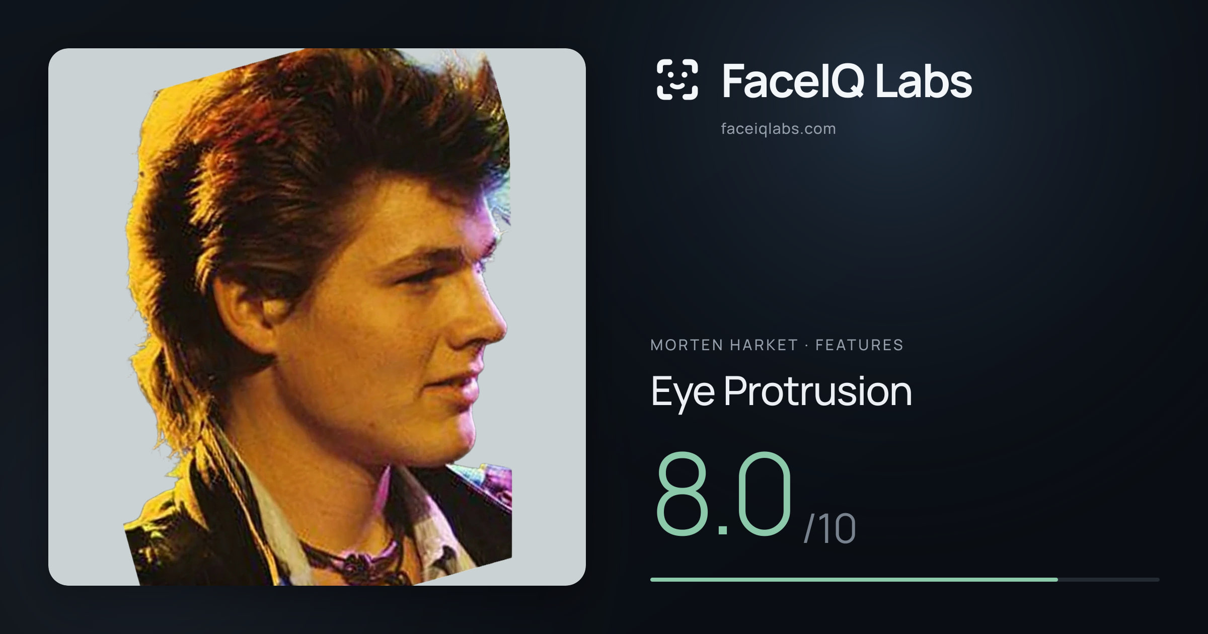 Morten Harket Eye Protrusion: 8.0/10, drawn on the photo