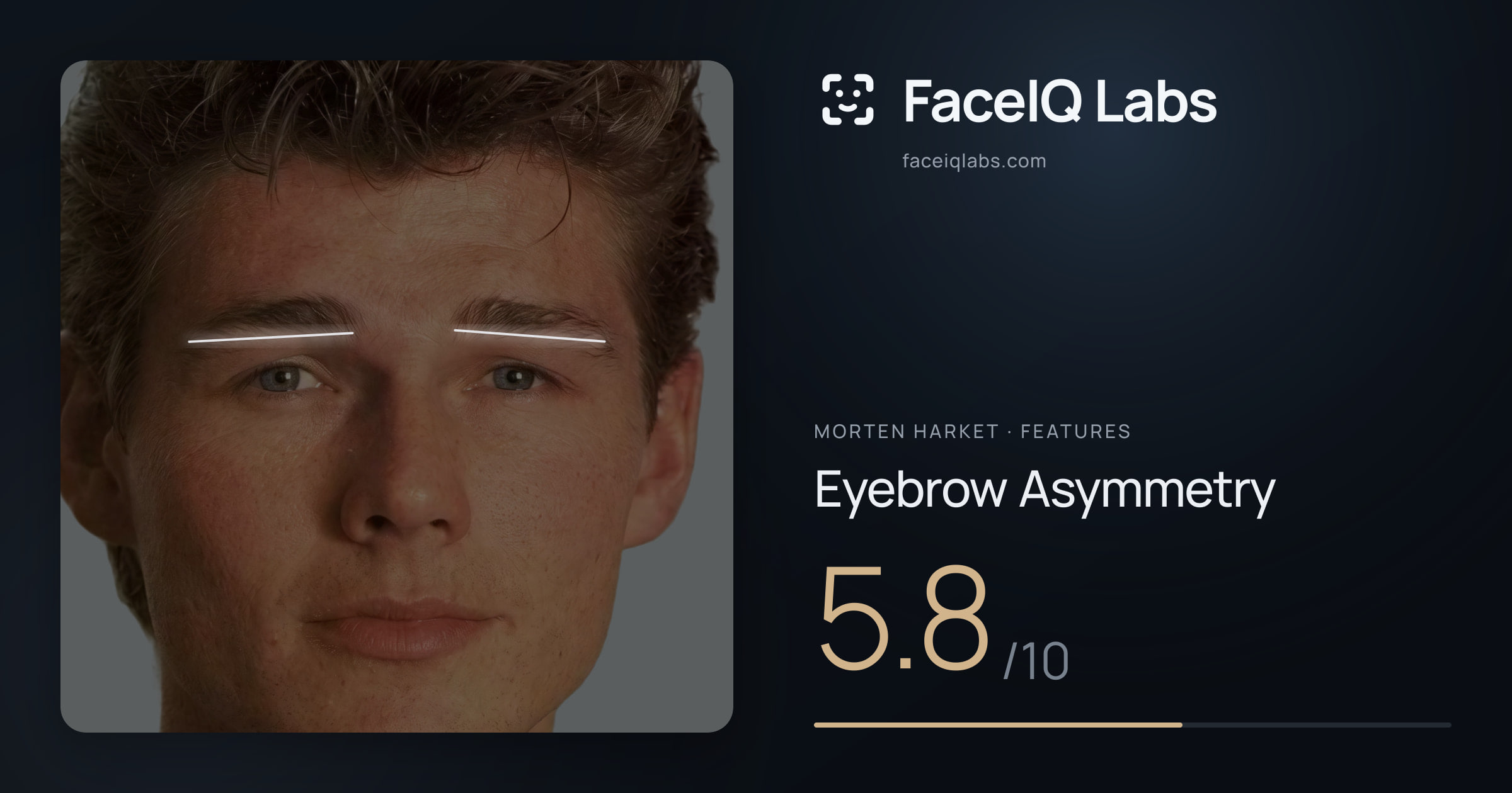 Morten Harket Eyebrow Asymmetry: 5.8/10, drawn on the photo