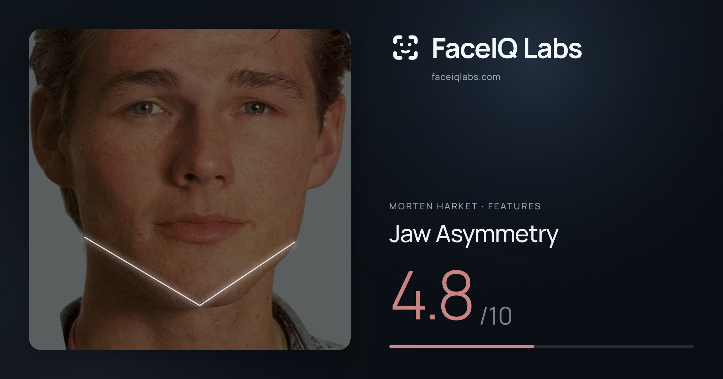 Morten Harket Jaw Asymmetry: 4.8/10, drawn on the photo