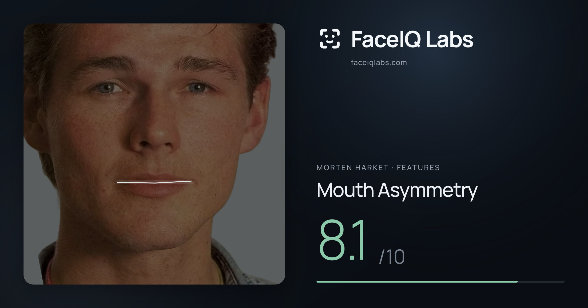Morten Harket Mouth Asymmetry: 8.1/10, drawn on the photo