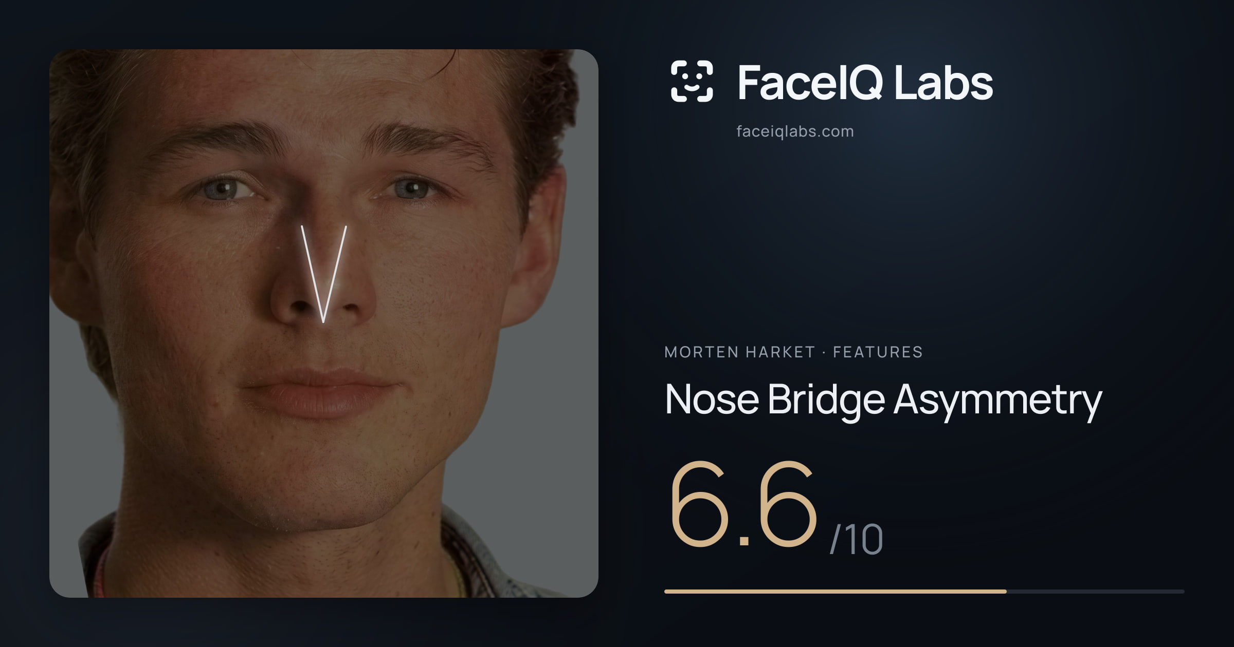 Morten Harket Nose Bridge Asymmetry: 6.6/10, drawn on the photo