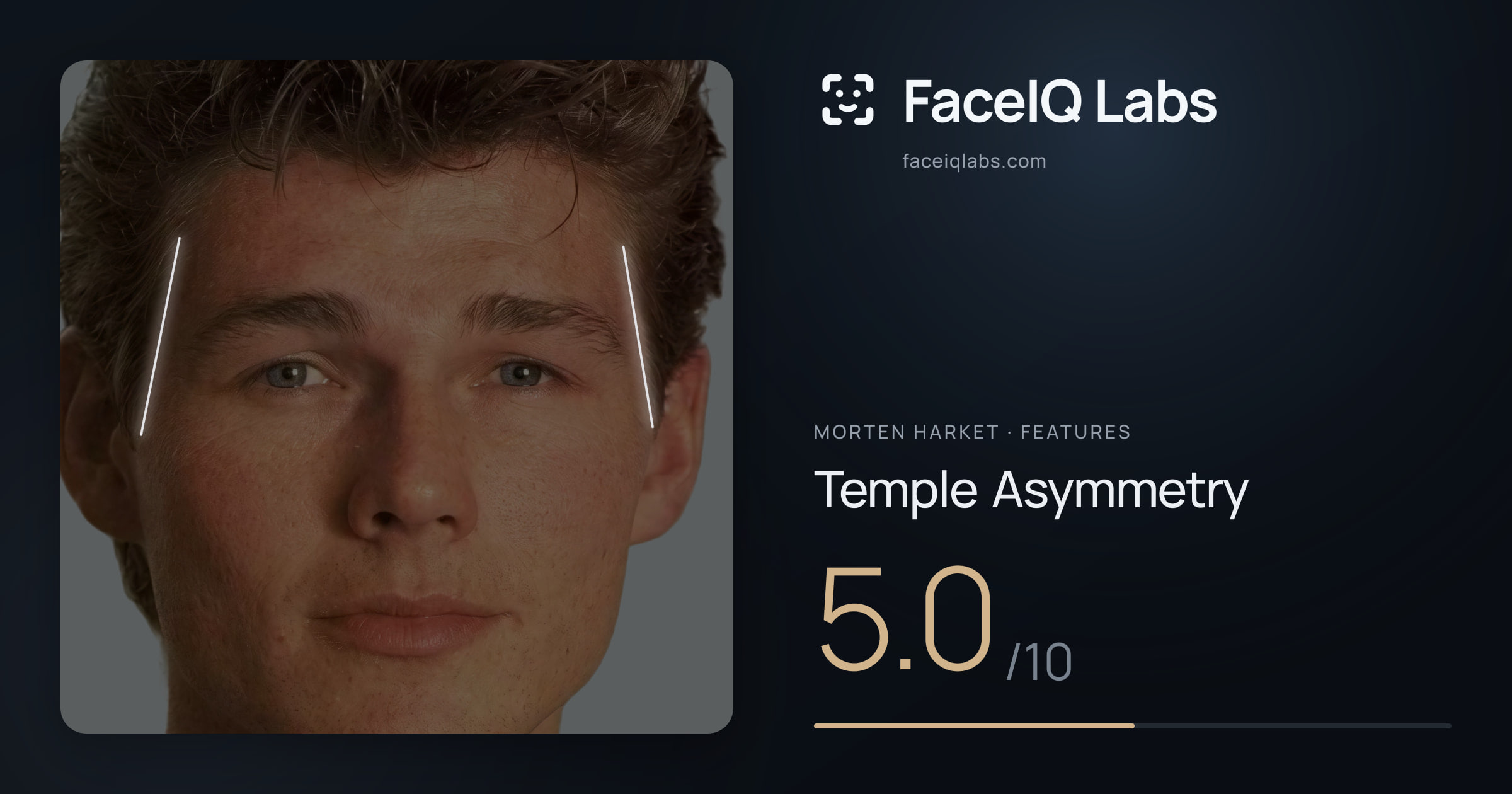 Morten Harket Temple Asymmetry: 5.0/10, drawn on the photo
