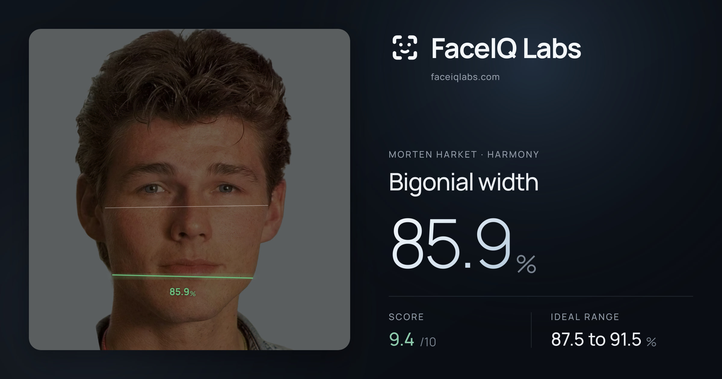 Morten Harket Bigonial width: 85.9%, drawn on the photo