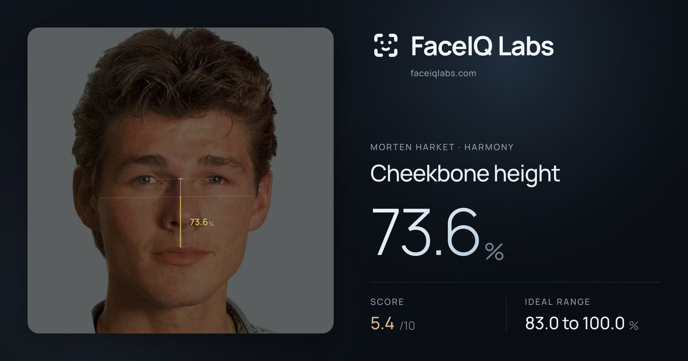Morten Harket Cheekbone height: 73.6%, drawn on the photo