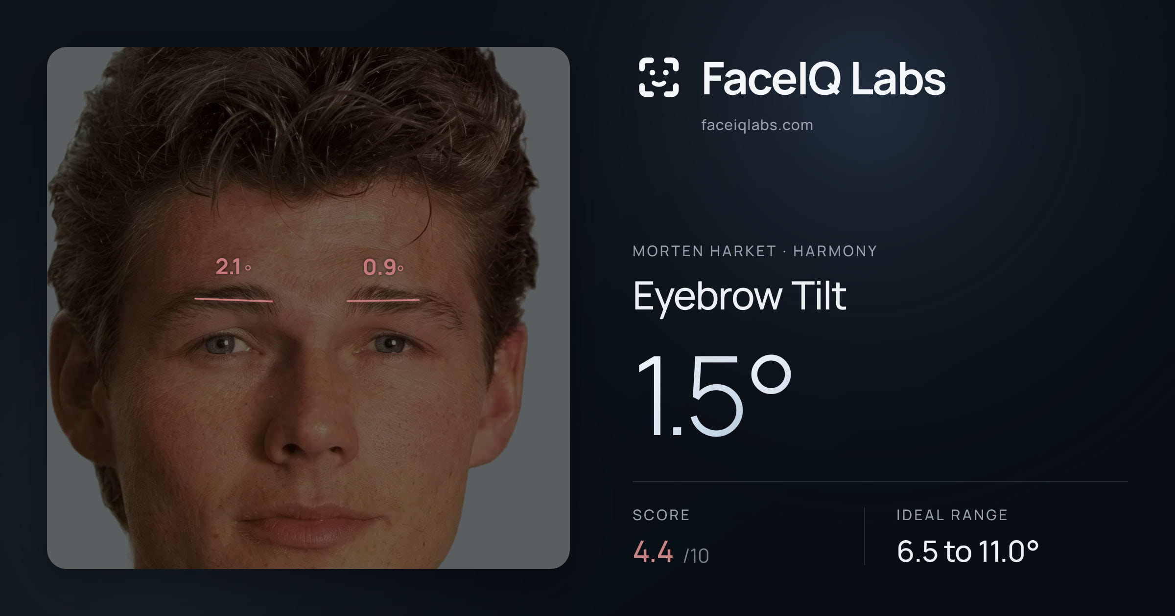 Morten Harket Eyebrow Tilt: 1.5°, drawn on the photo