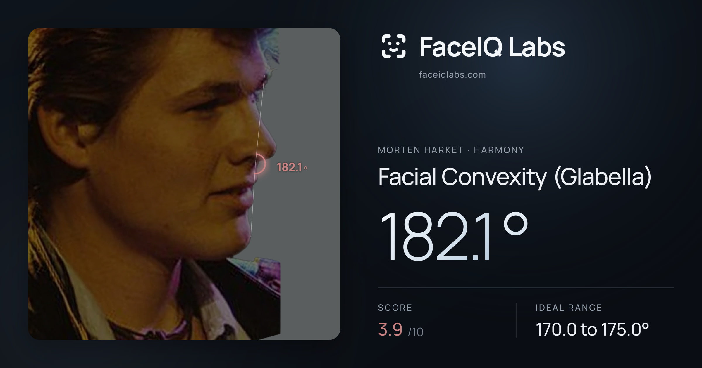 Morten Harket Facial Convexity (Glabella): 182.1°, drawn on the photo