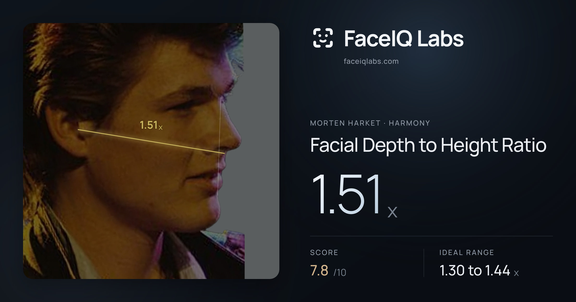 Morten Harket Facial Depth to Height Ratio: 1.51x, drawn on the photo