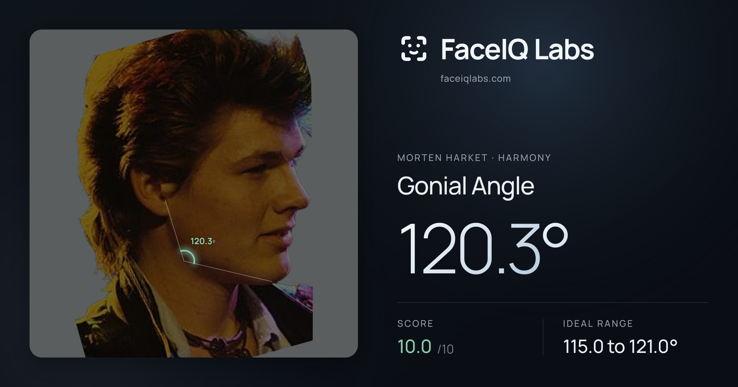 Morten Harket Gonial Angle: 120.3°, drawn on the photo