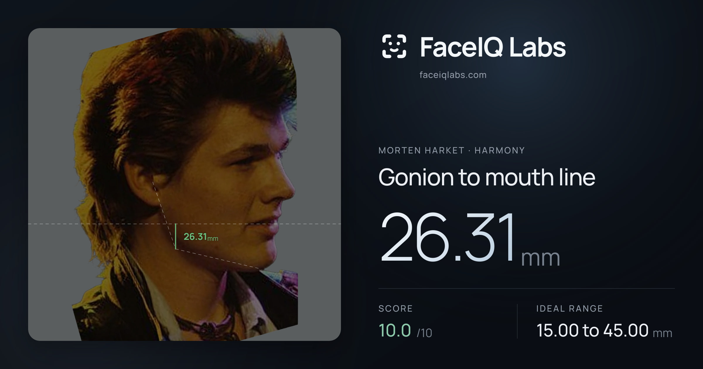 Morten Harket Gonion to mouth line: 26.31mm, drawn on the photo