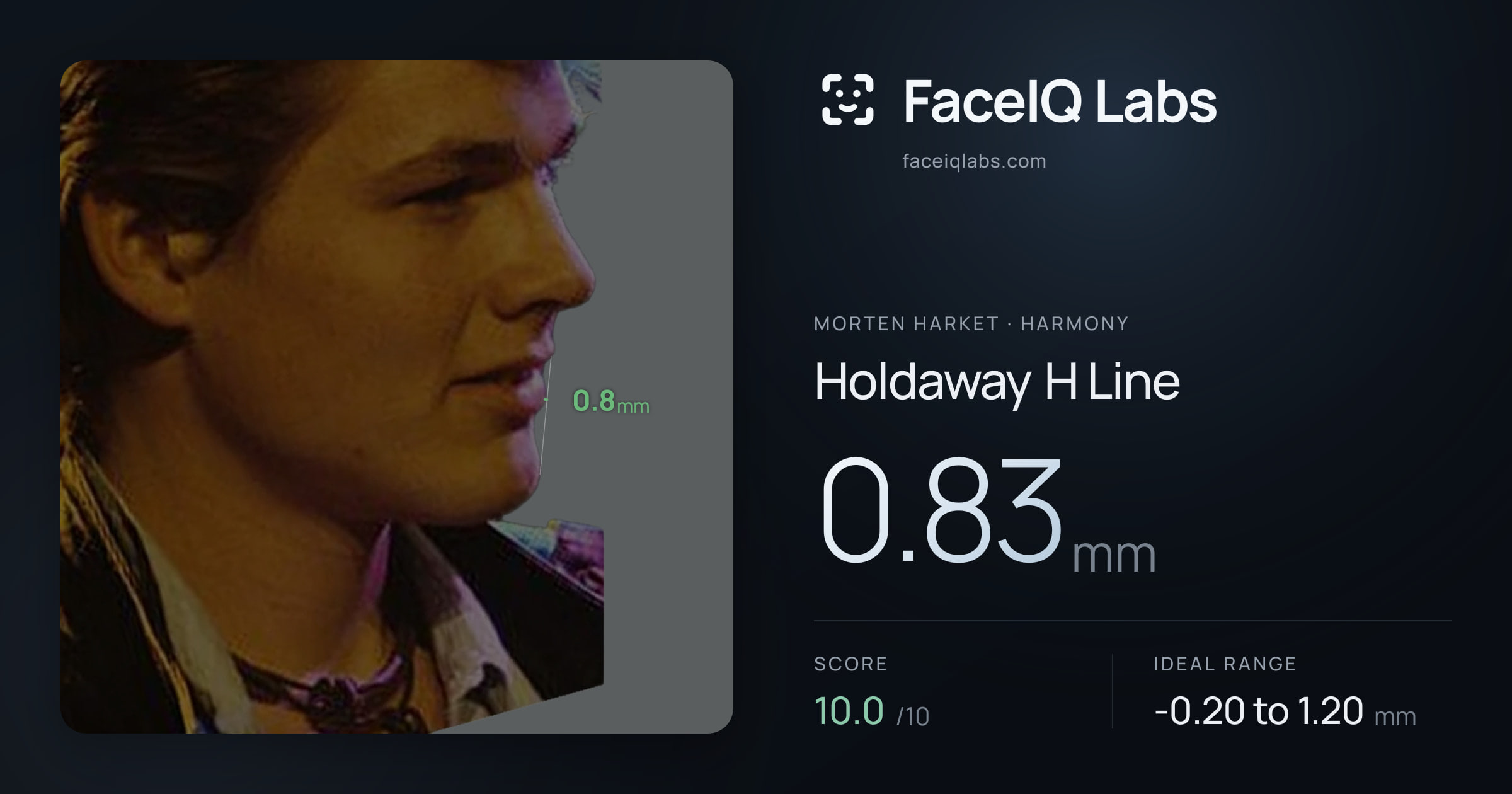 Morten Harket Holdaway H Line: 0.83mm, drawn on the photo