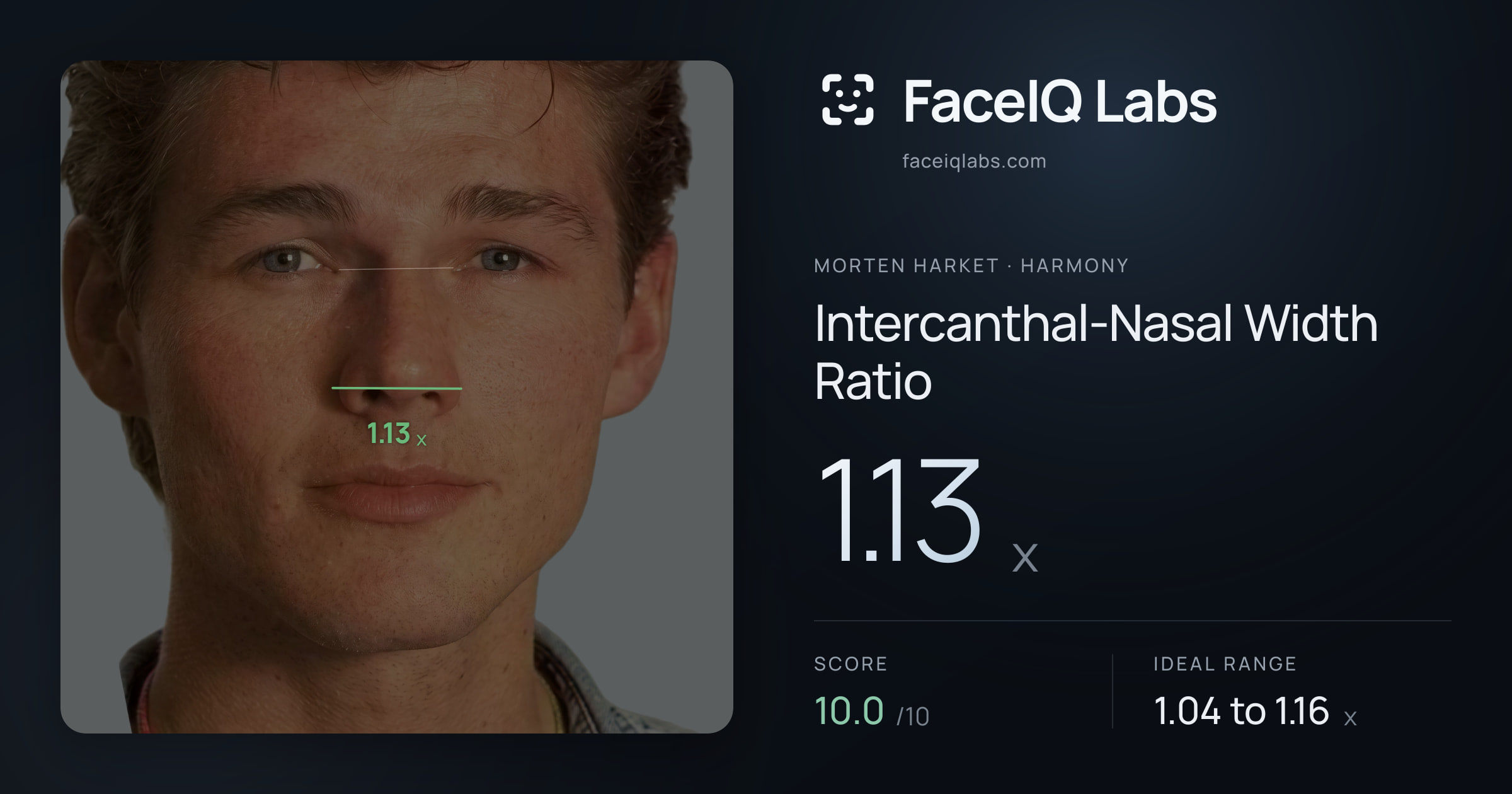 Morten Harket Intercanthal-Nasal Width Ratio: 1.13x, drawn on the photo