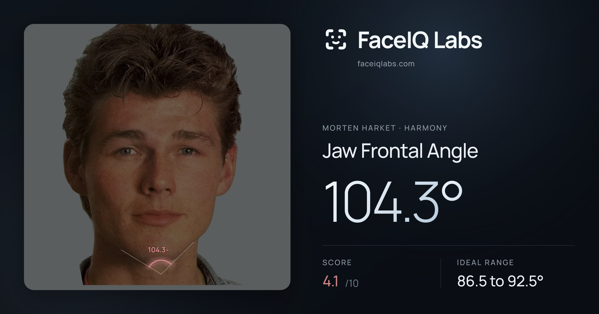 Morten Harket Jaw Frontal Angle: 104.3°, drawn on the photo