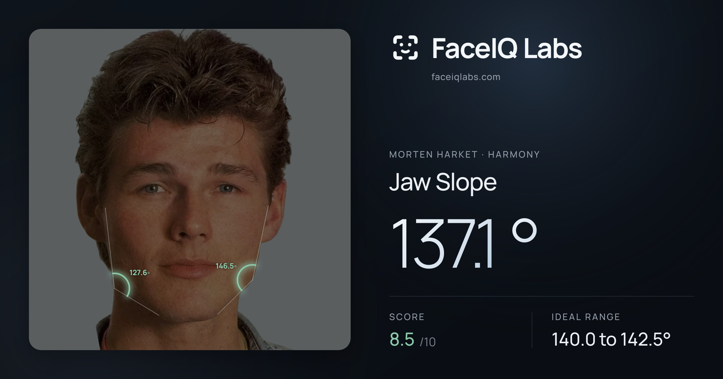 Morten Harket Jaw Slope: 137.1°, drawn on the photo