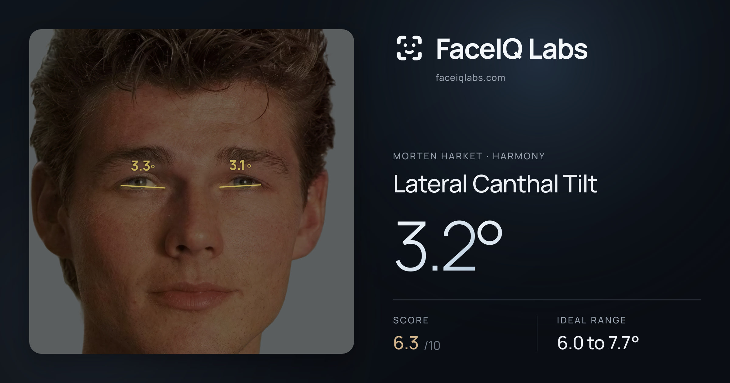 Morten Harket Lateral Canthal Tilt: 3.2°, drawn on the photo
