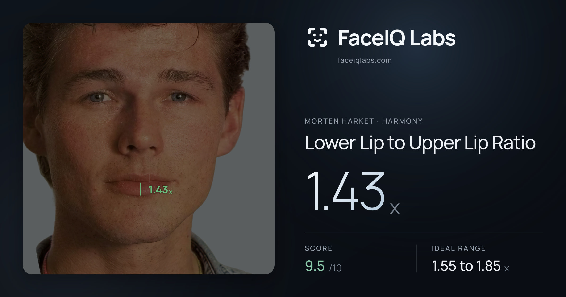 Morten Harket Lower Lip to Upper Lip Ratio: 1.43x, drawn on the photo