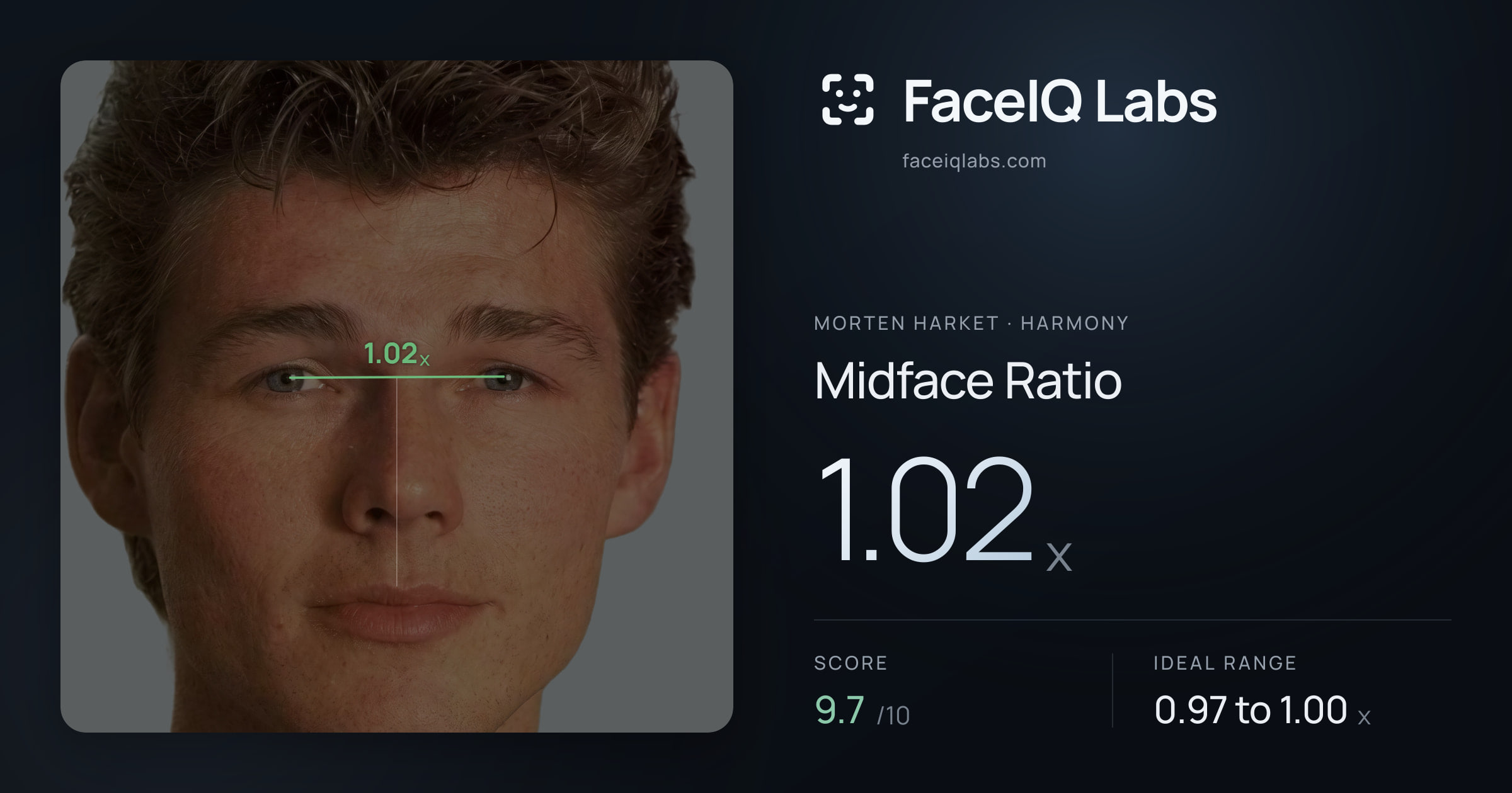 Morten Harket Midface Ratio: 1.02x, drawn on the photo