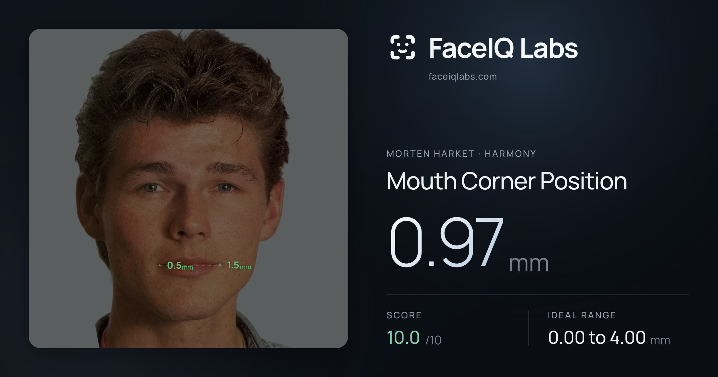 Morten Harket Mouth Corner Position: 0.97mm, drawn on the photo