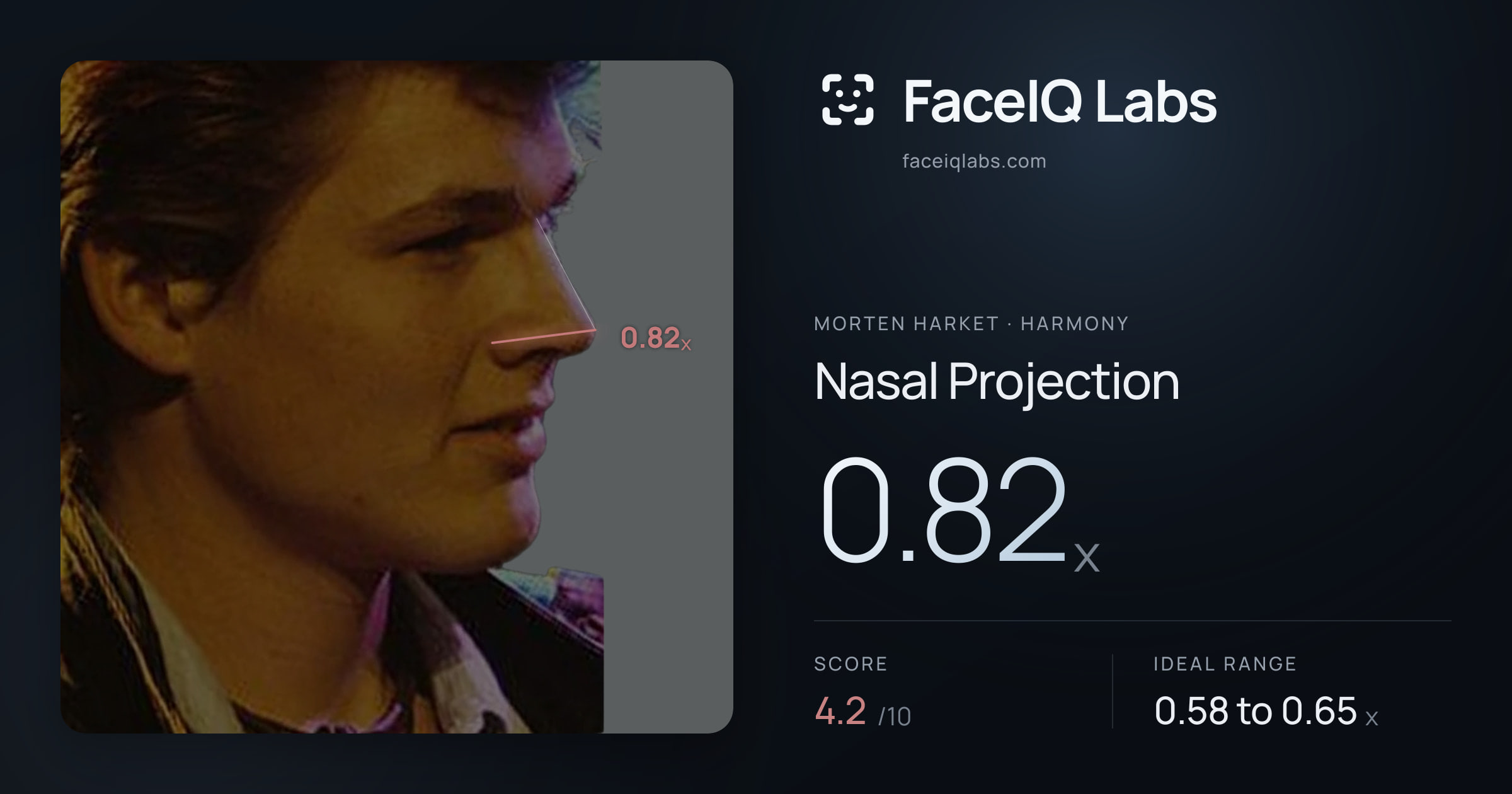 Morten Harket Nasal Projection: 0.82x, drawn on the photo