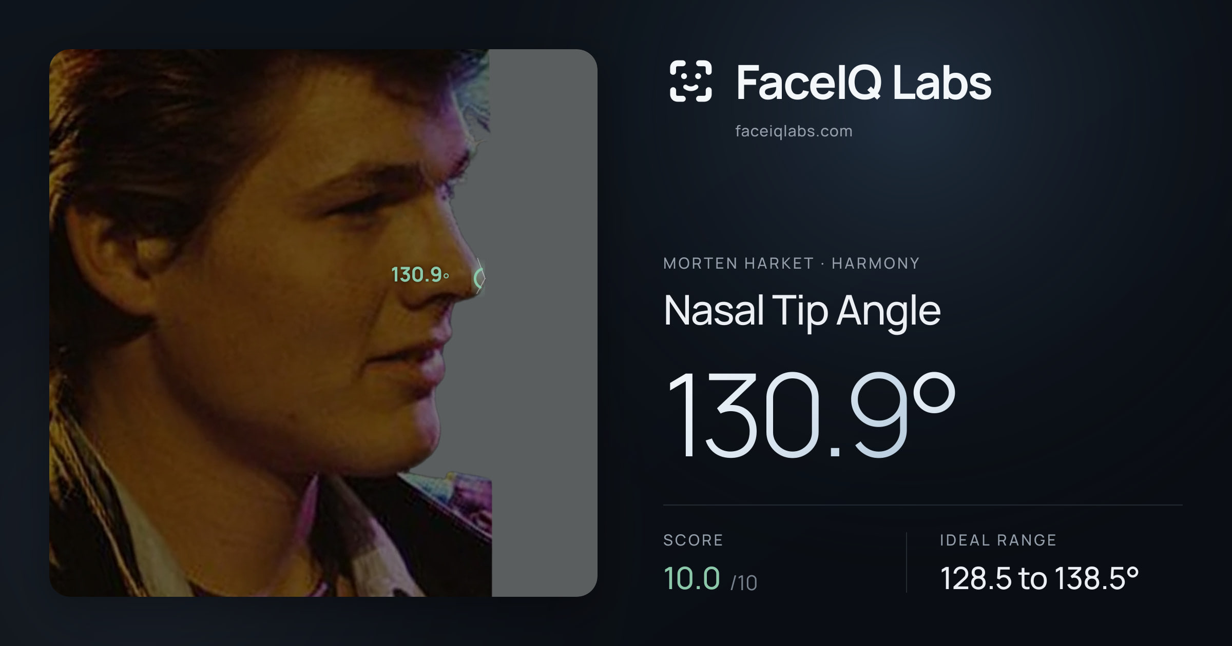 Morten Harket Nasal Tip Angle: 130.9°, drawn on the photo