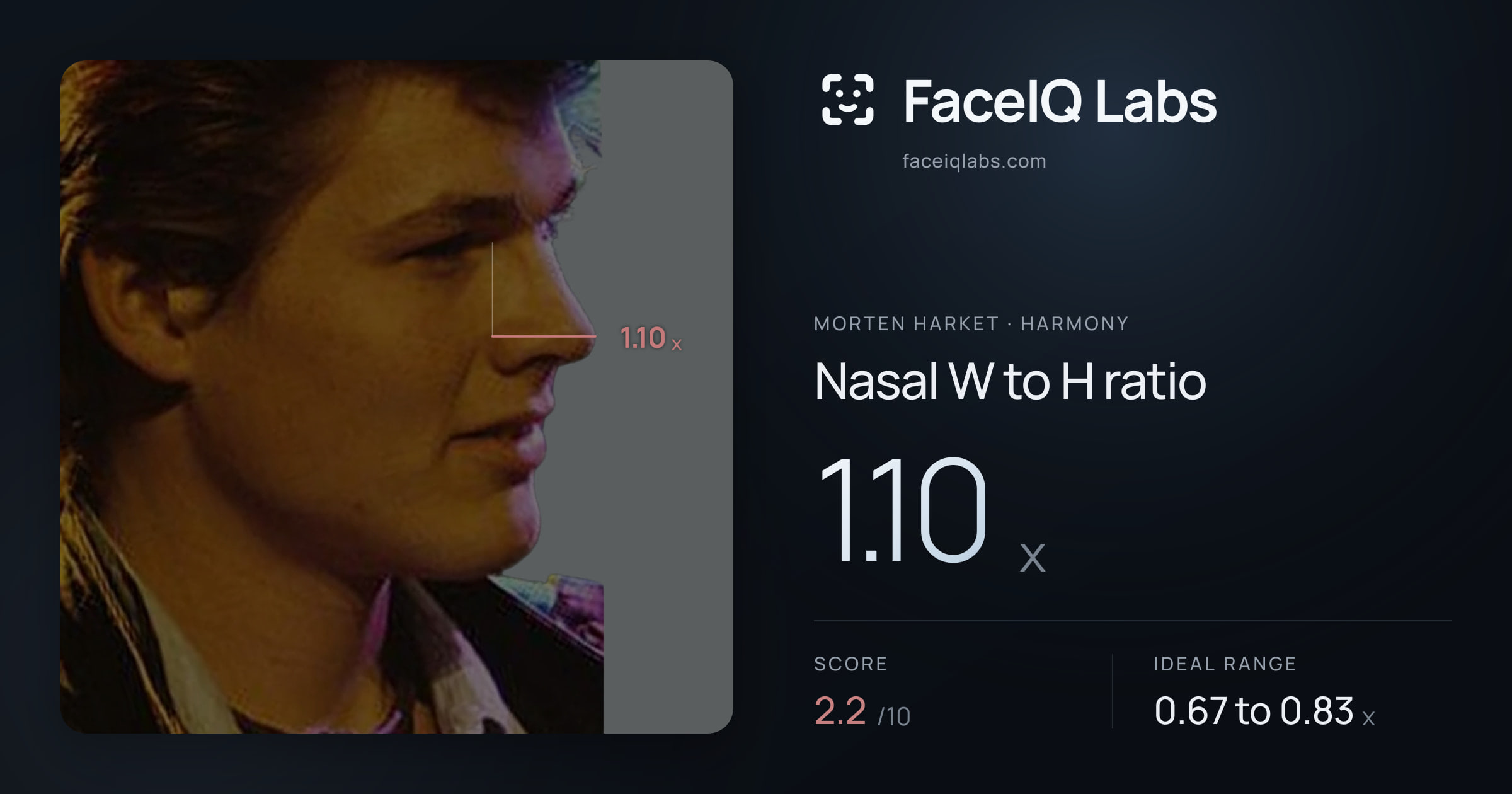 Morten Harket Nasal W to H ratio: 1.10x, drawn on the photo
