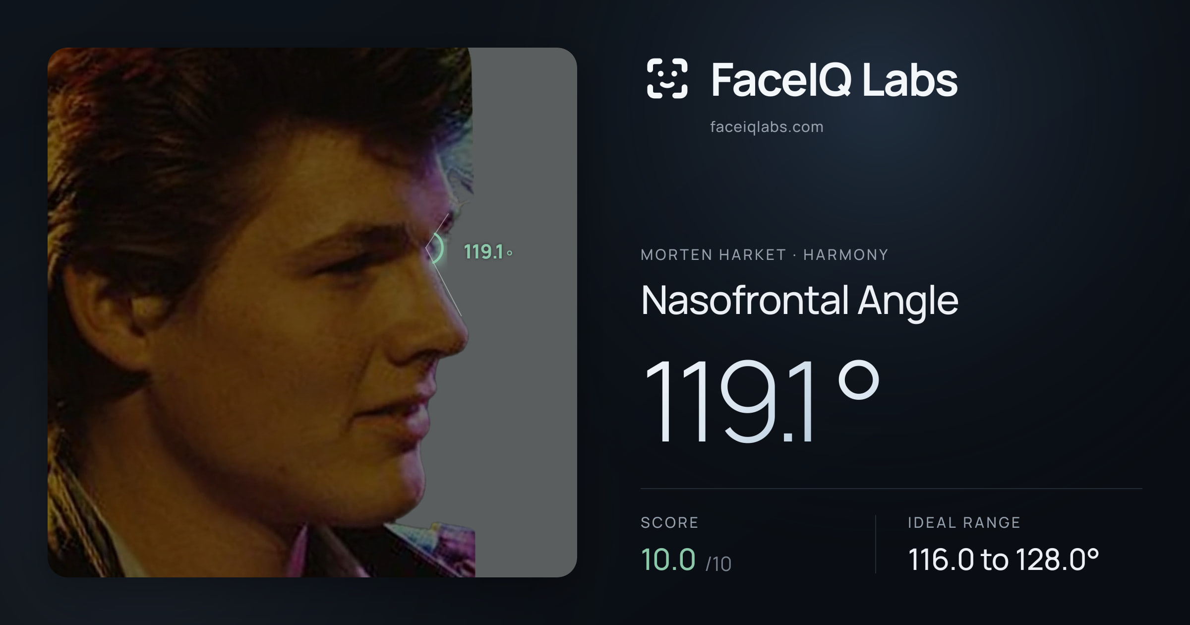 Morten Harket Nasofrontal Angle: 119.1°, drawn on the photo