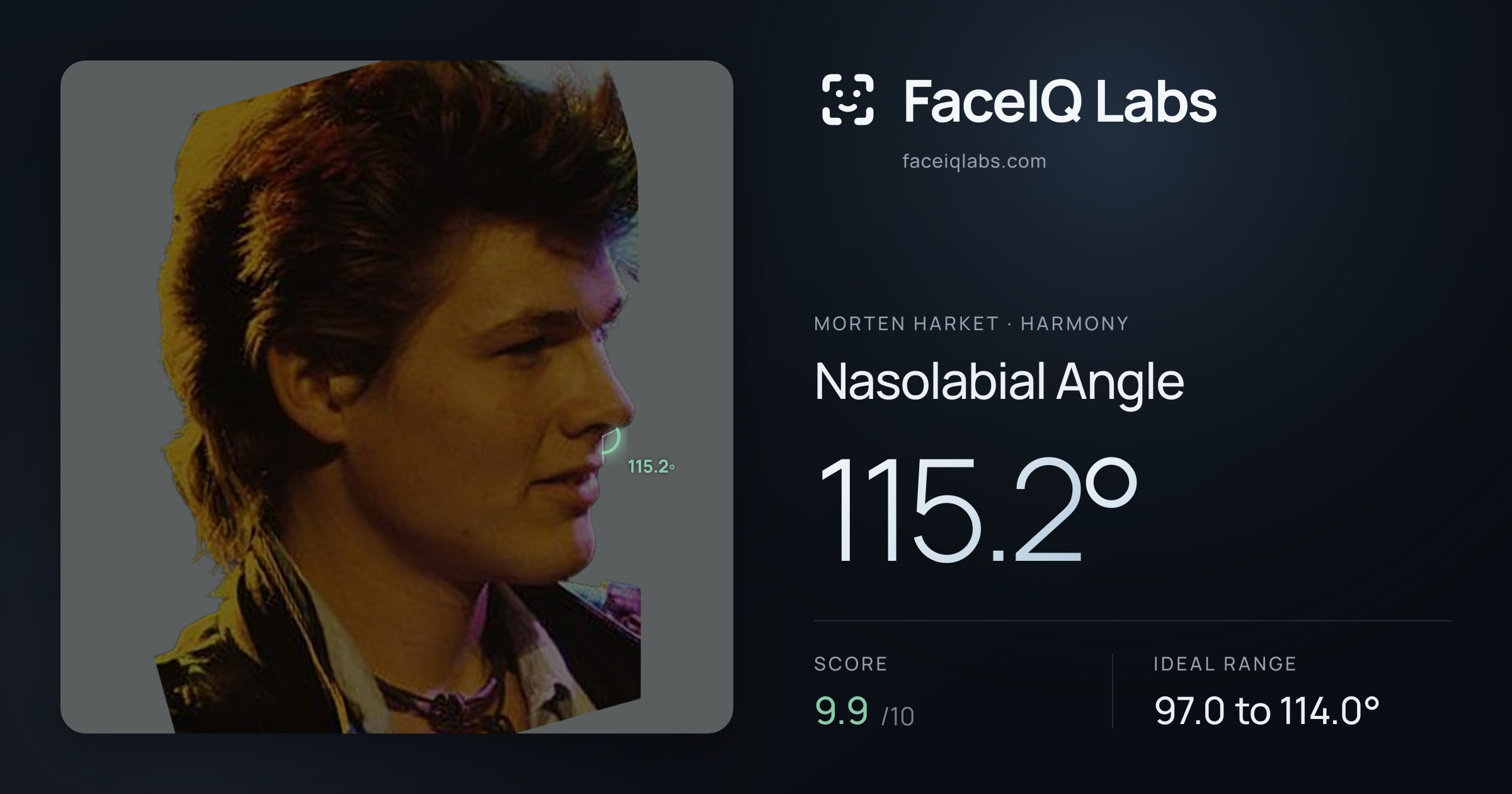 Morten Harket Nasolabial Angle: 115.2°, drawn on the photo