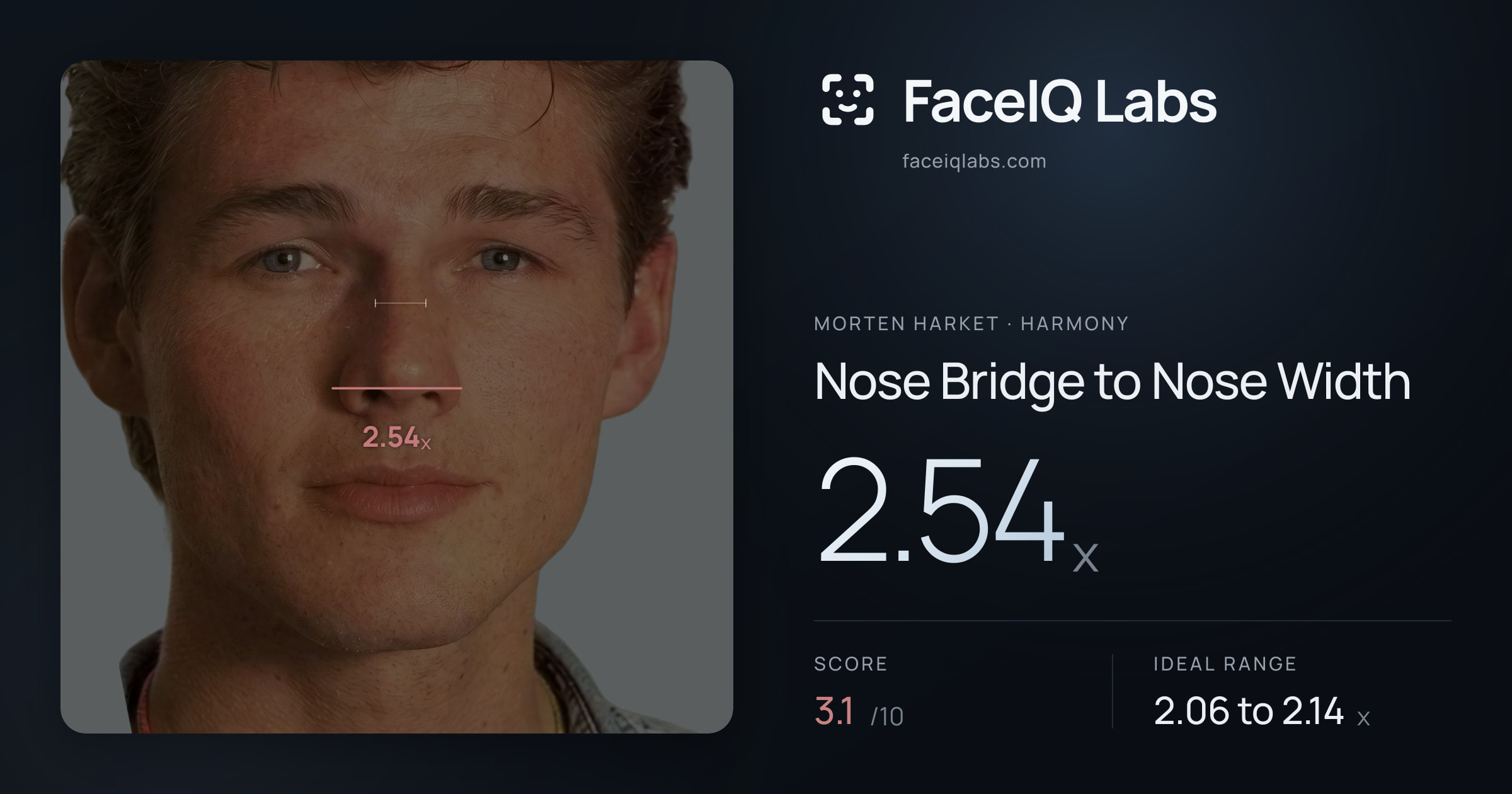 Morten Harket Nose Bridge to Nose Width: 2.54x, drawn on the photo