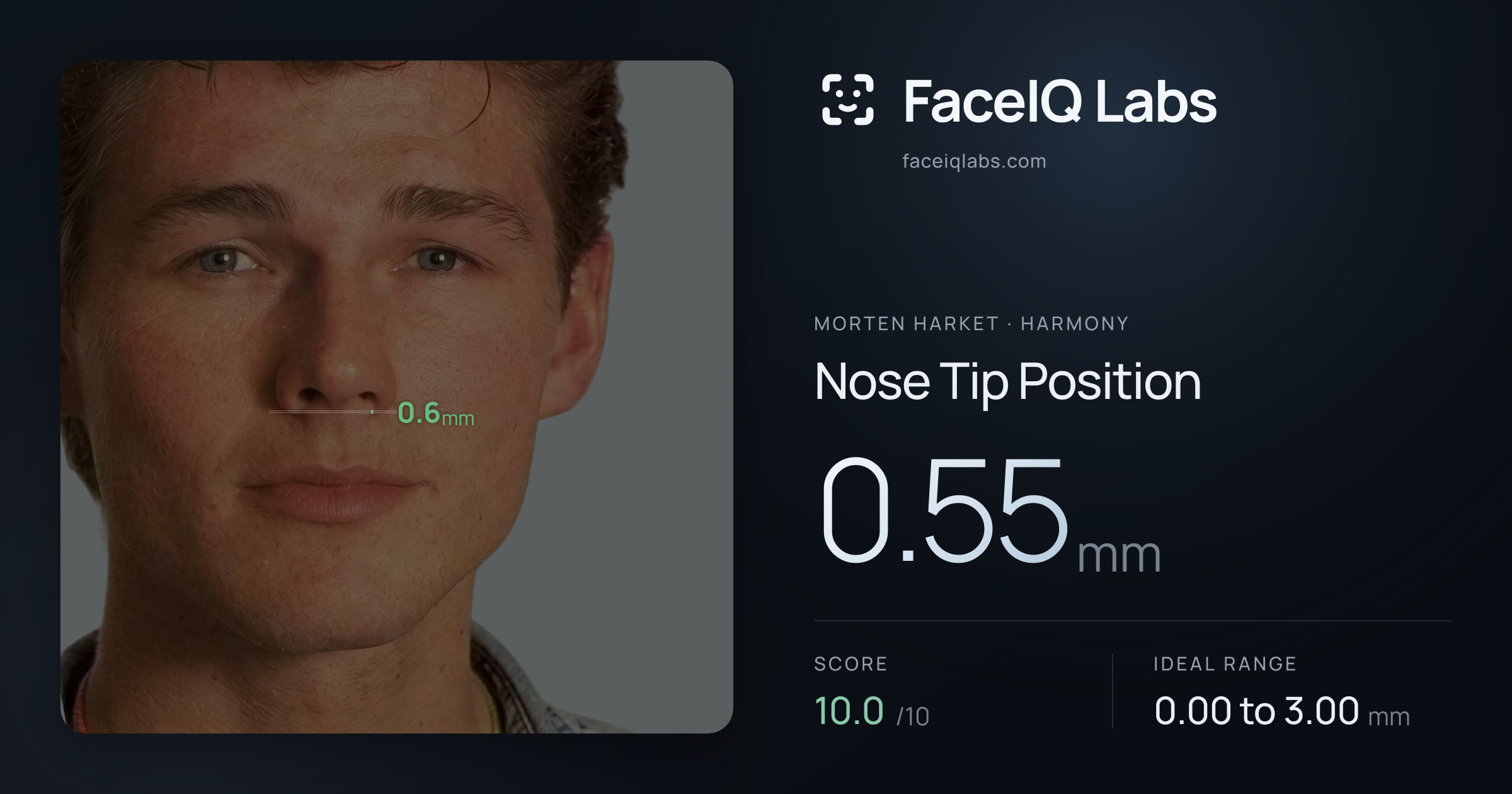 Morten Harket Nose Tip Position: 0.55mm, drawn on the photo
