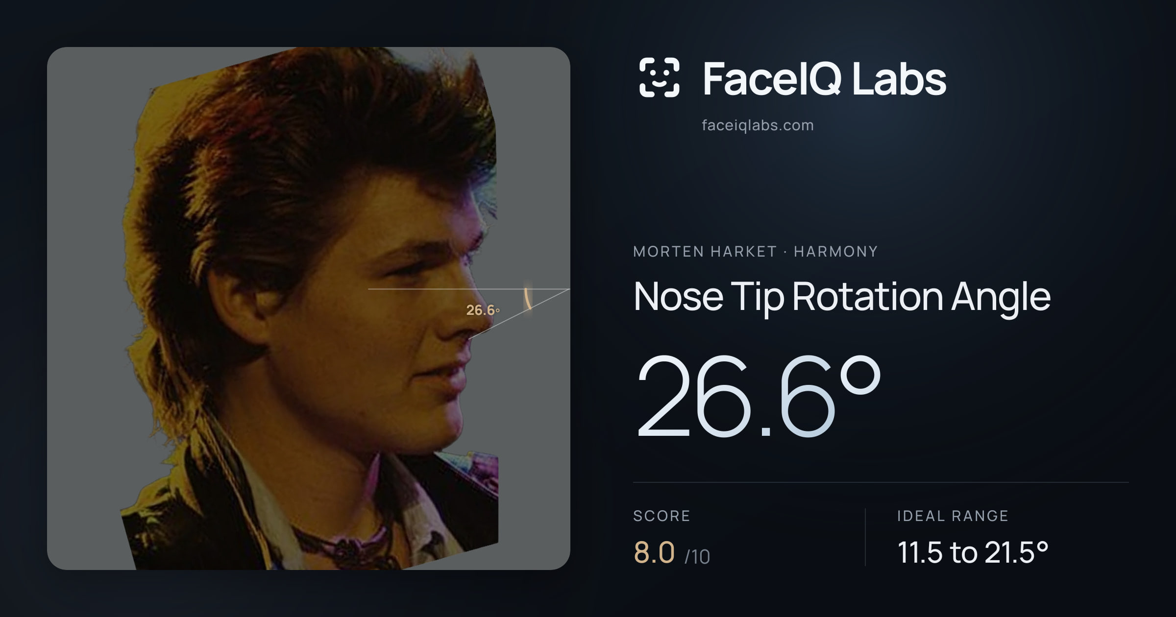 Morten Harket Nose Tip Rotation Angle: 26.6°, drawn on the photo