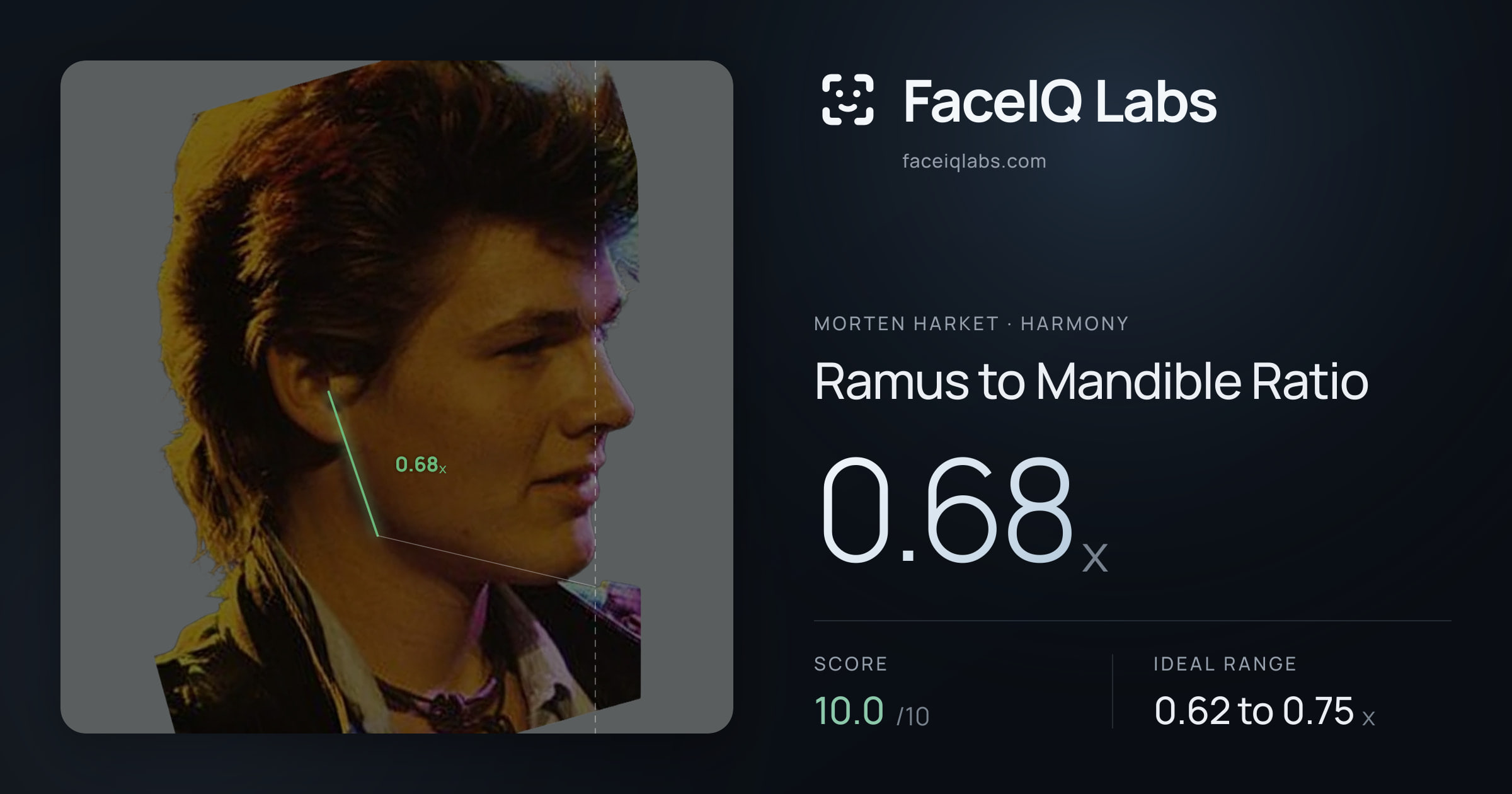 Morten Harket Ramus to Mandible Ratio: 0.68x, drawn on the photo