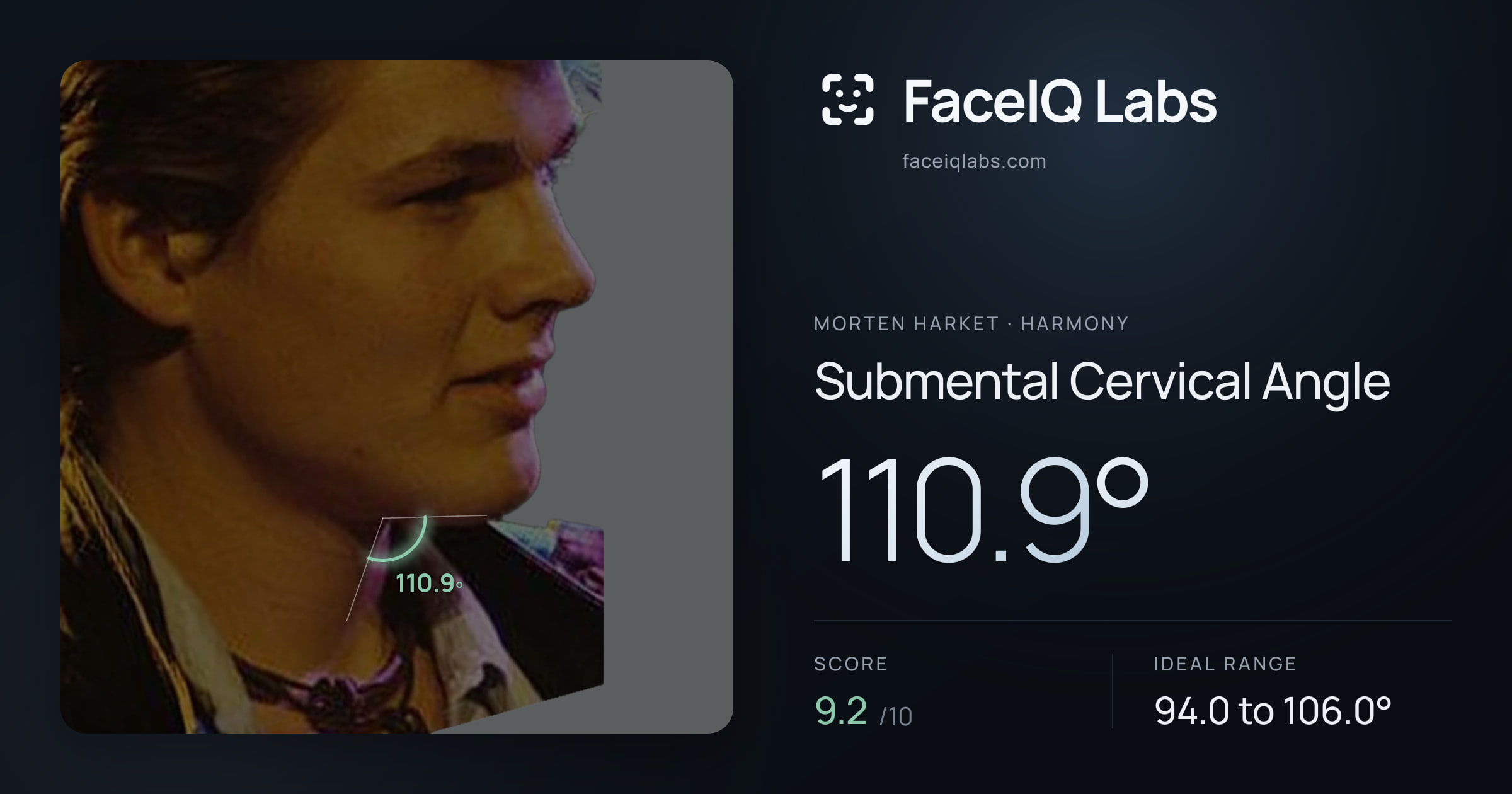 Morten Harket Submental Cervical Angle: 110.9°, drawn on the photo