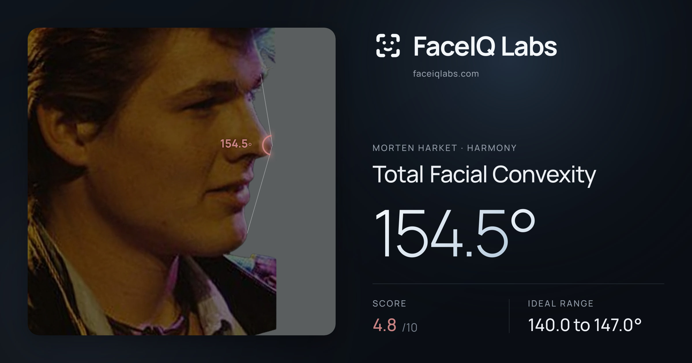 Morten Harket Total Facial Convexity: 154.5°, drawn on the photo