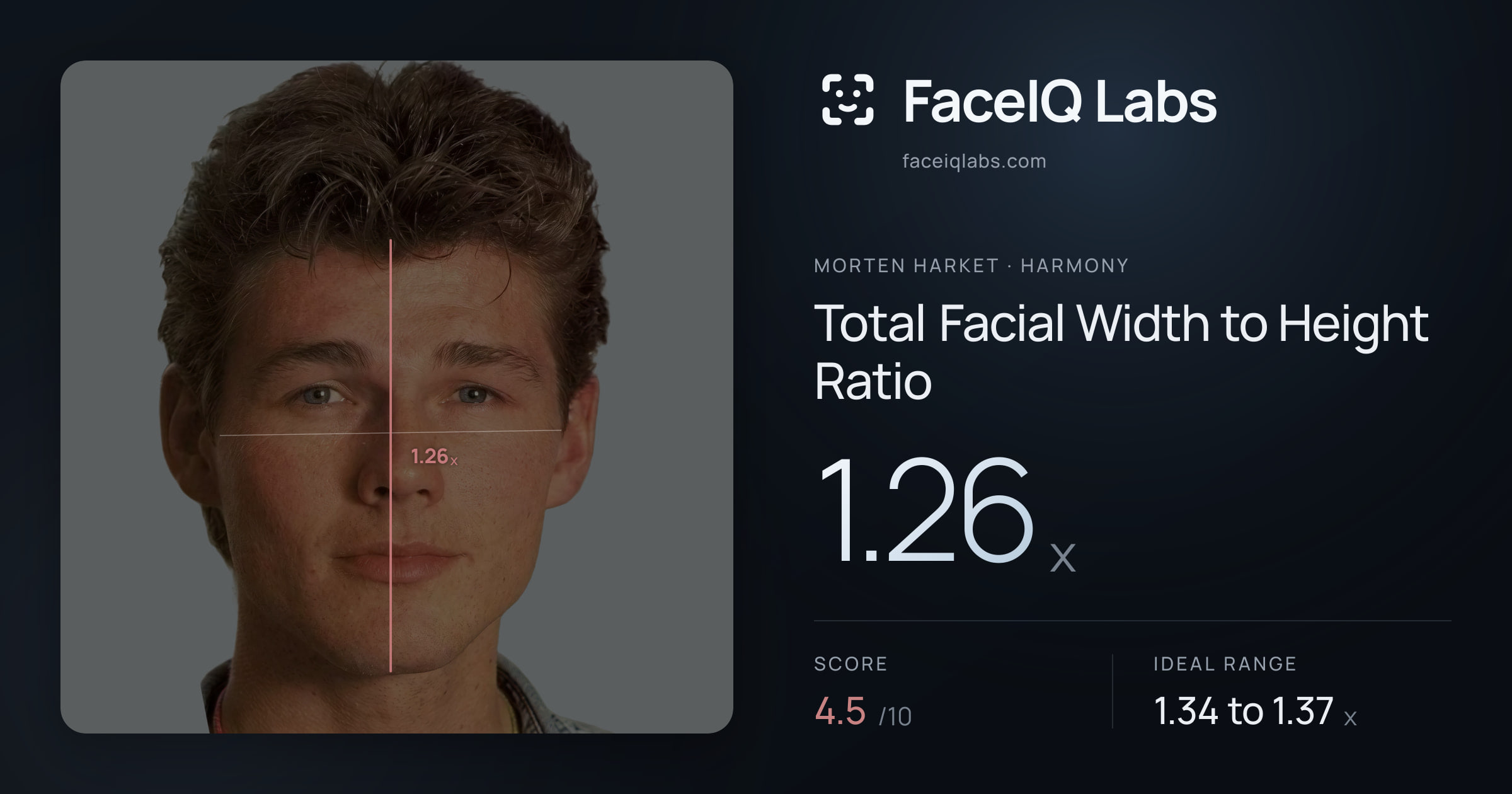 Morten Harket Total Facial Width to Height Ratio: 1.26x, drawn on the photo