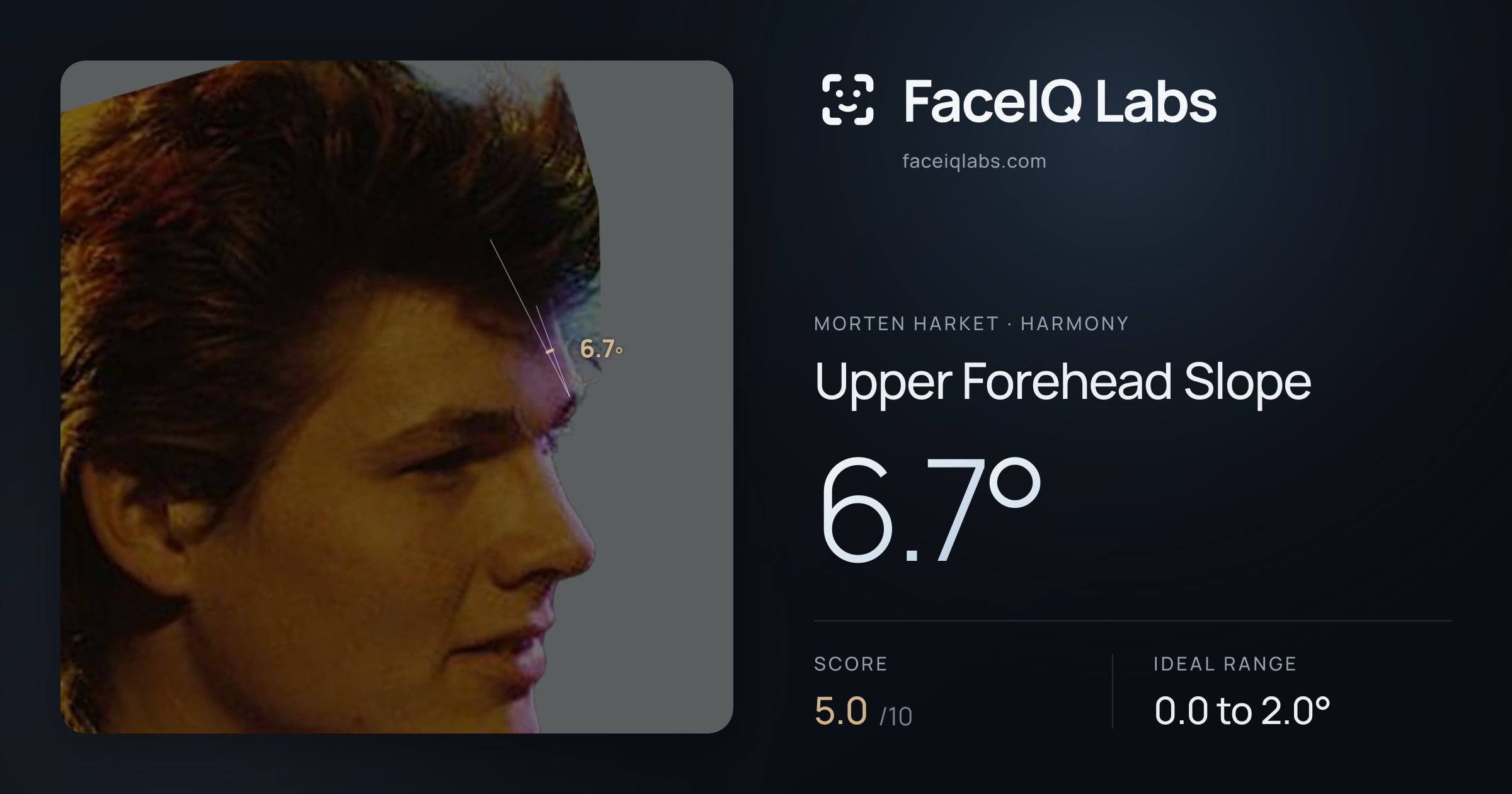 Morten Harket Upper Forehead Slope: 6.7°, drawn on the photo