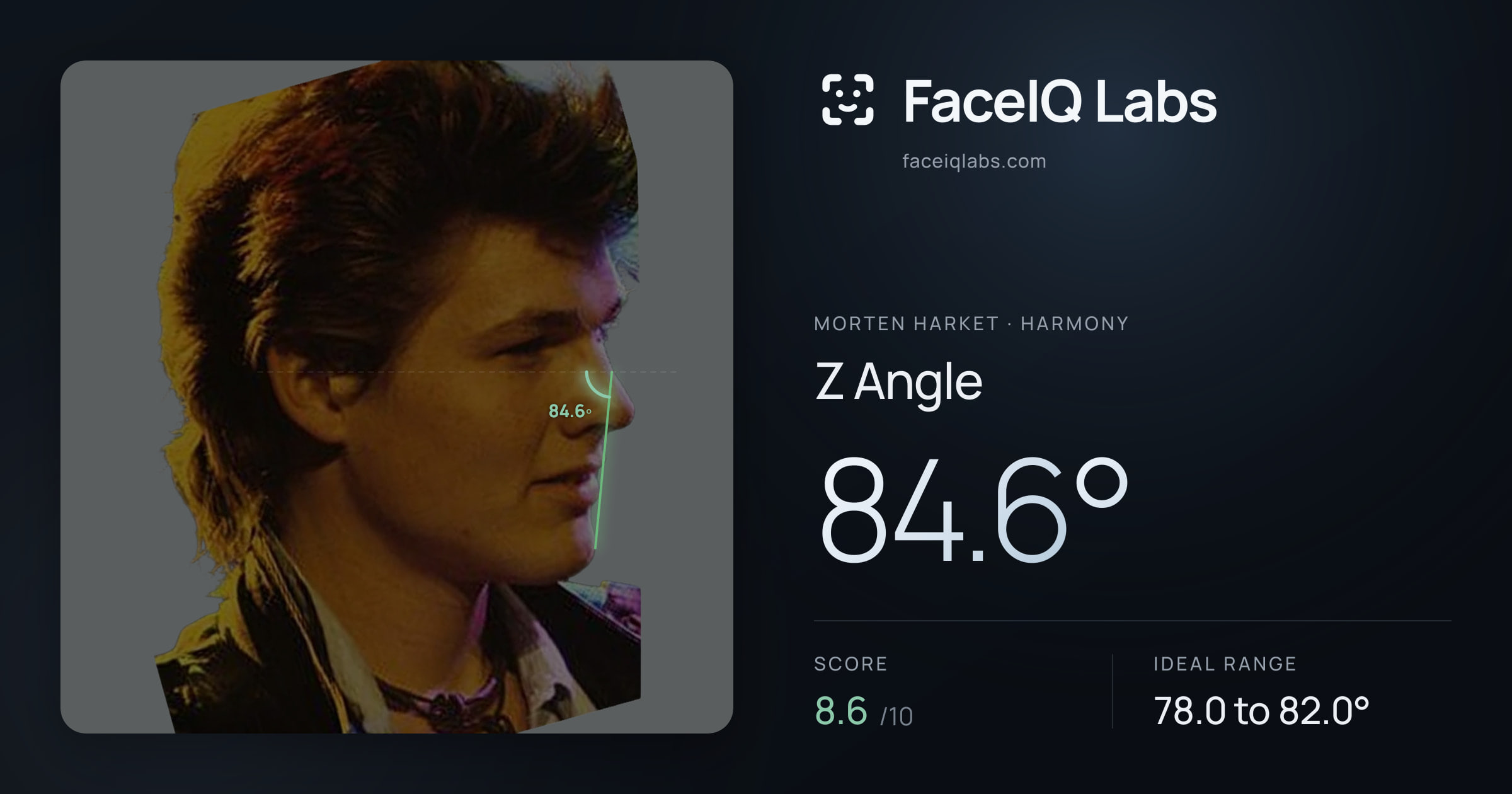 Morten Harket Z Angle: 84.6°, drawn on the photo