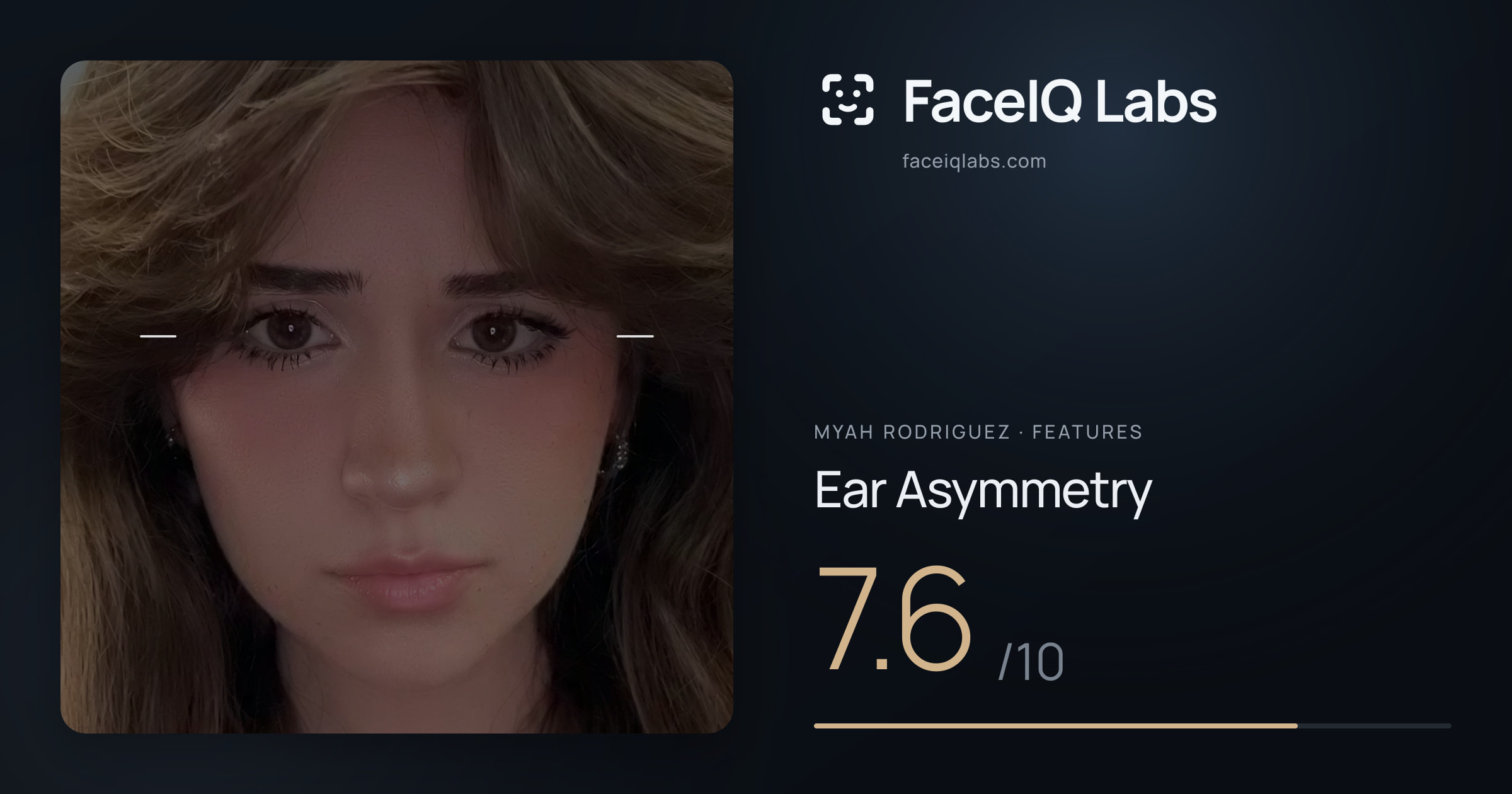 Myah Rodriguez Ear Asymmetry: 7.6/10, drawn on the photo