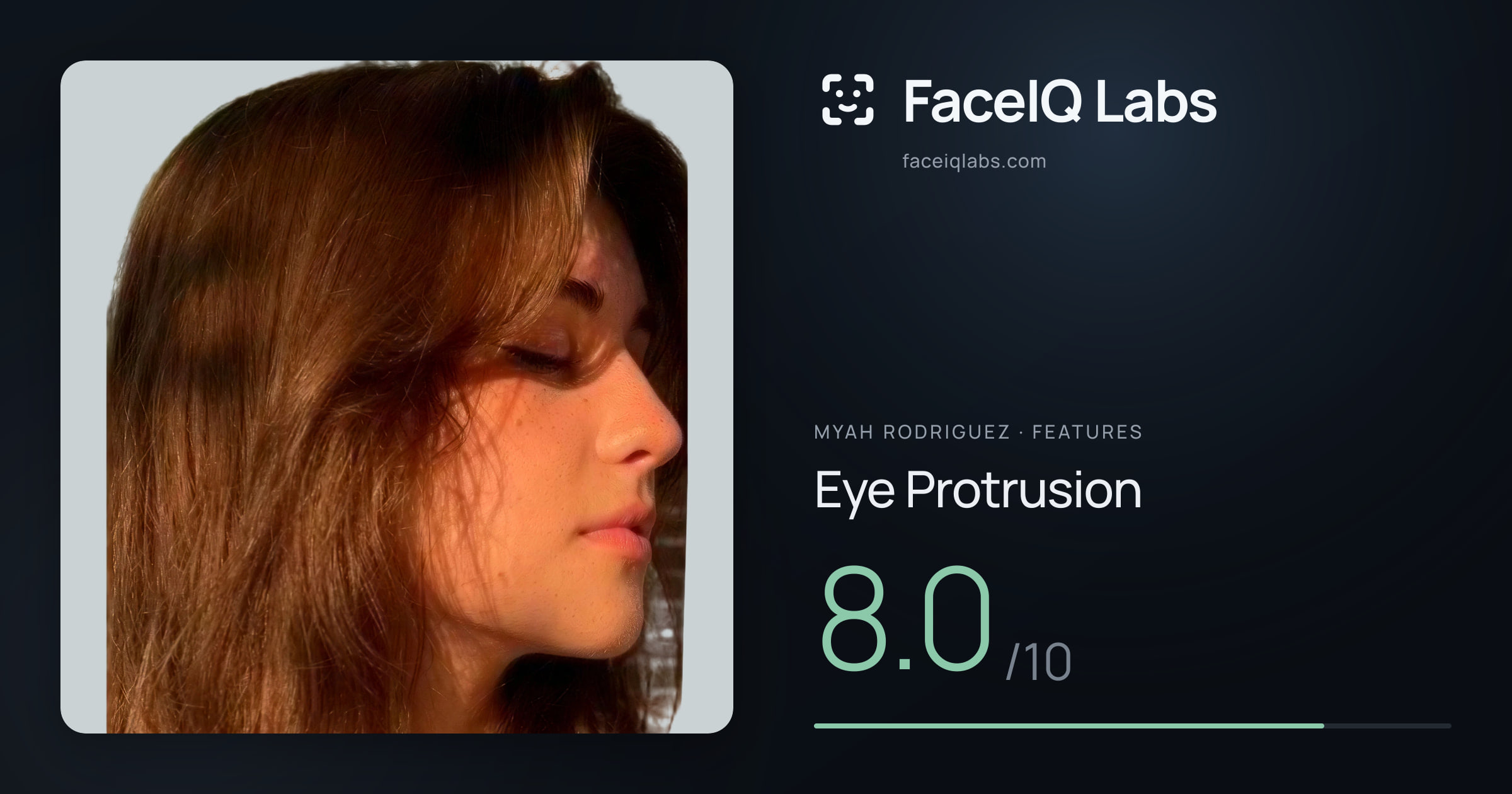Myah Rodriguez Eye Protrusion: 8.0/10, drawn on the photo