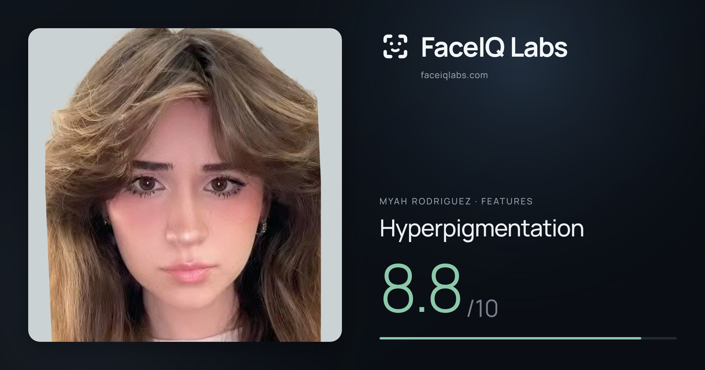 Myah Rodriguez Hyperpigmentation: 8.8/10, drawn on the photo