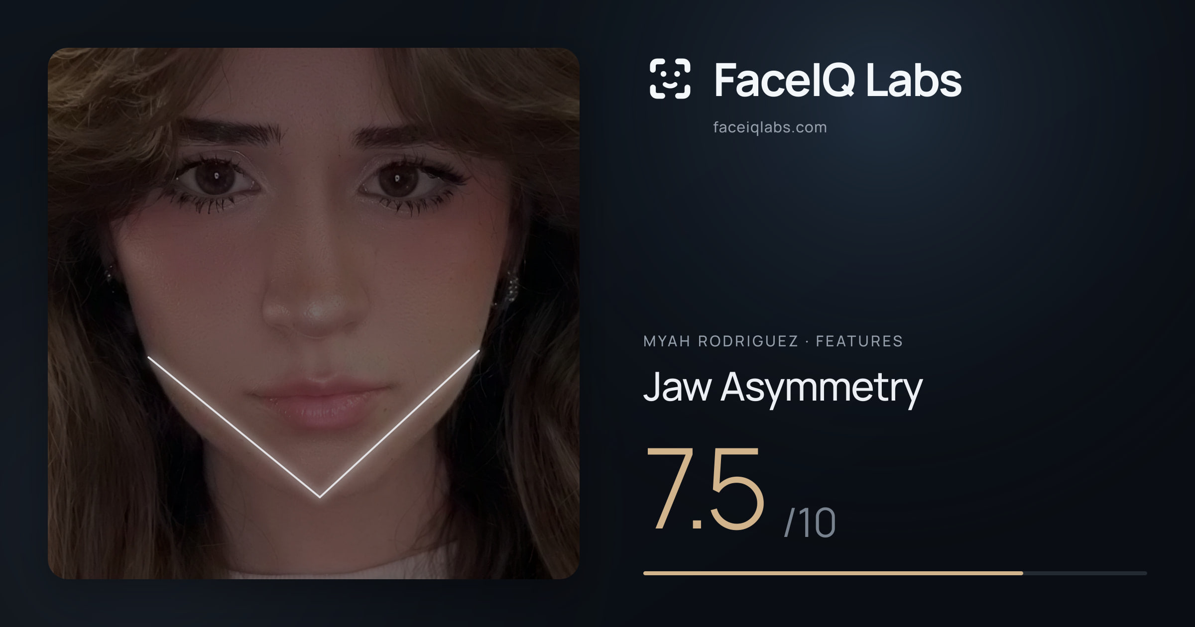Myah Rodriguez Jaw Asymmetry: 7.5/10, drawn on the photo