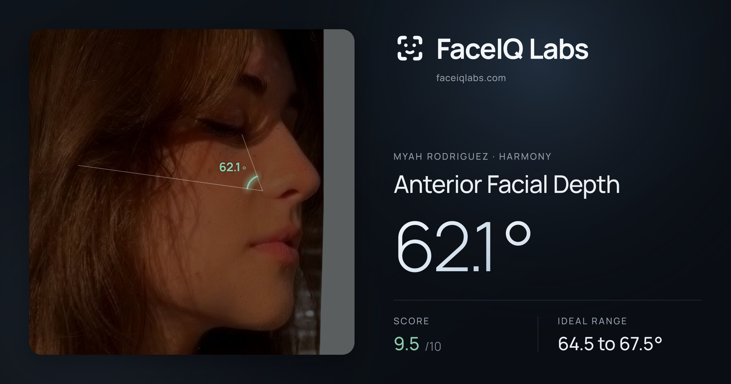 Myah Rodriguez Anterior Facial Depth: 62.1°, drawn on the photo