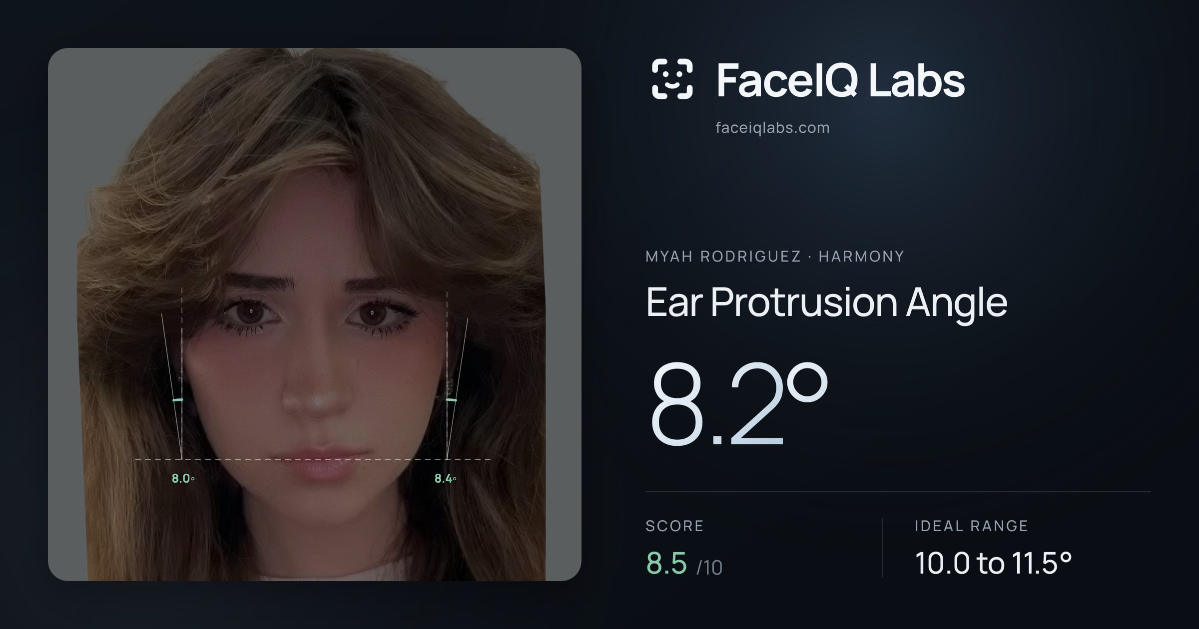 Myah Rodriguez Ear Protrusion Angle: 8.2°, drawn on the photo